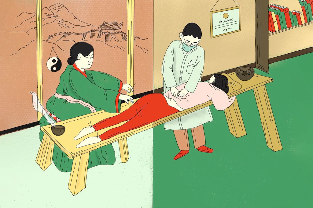 Traditionelle Chinesische Medizin: Akupunktur und Co. auf dem Vormarsch