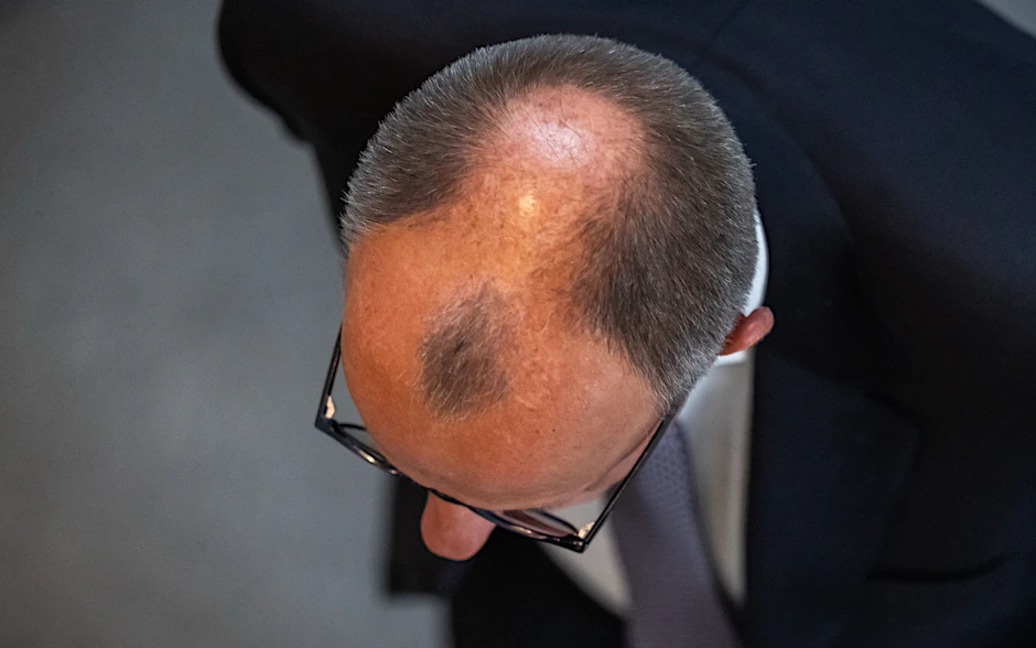 Die bekannteste Insel Deutschlands ist nicht Sylt, sondern die Haarinsel von Friedrich Merz.