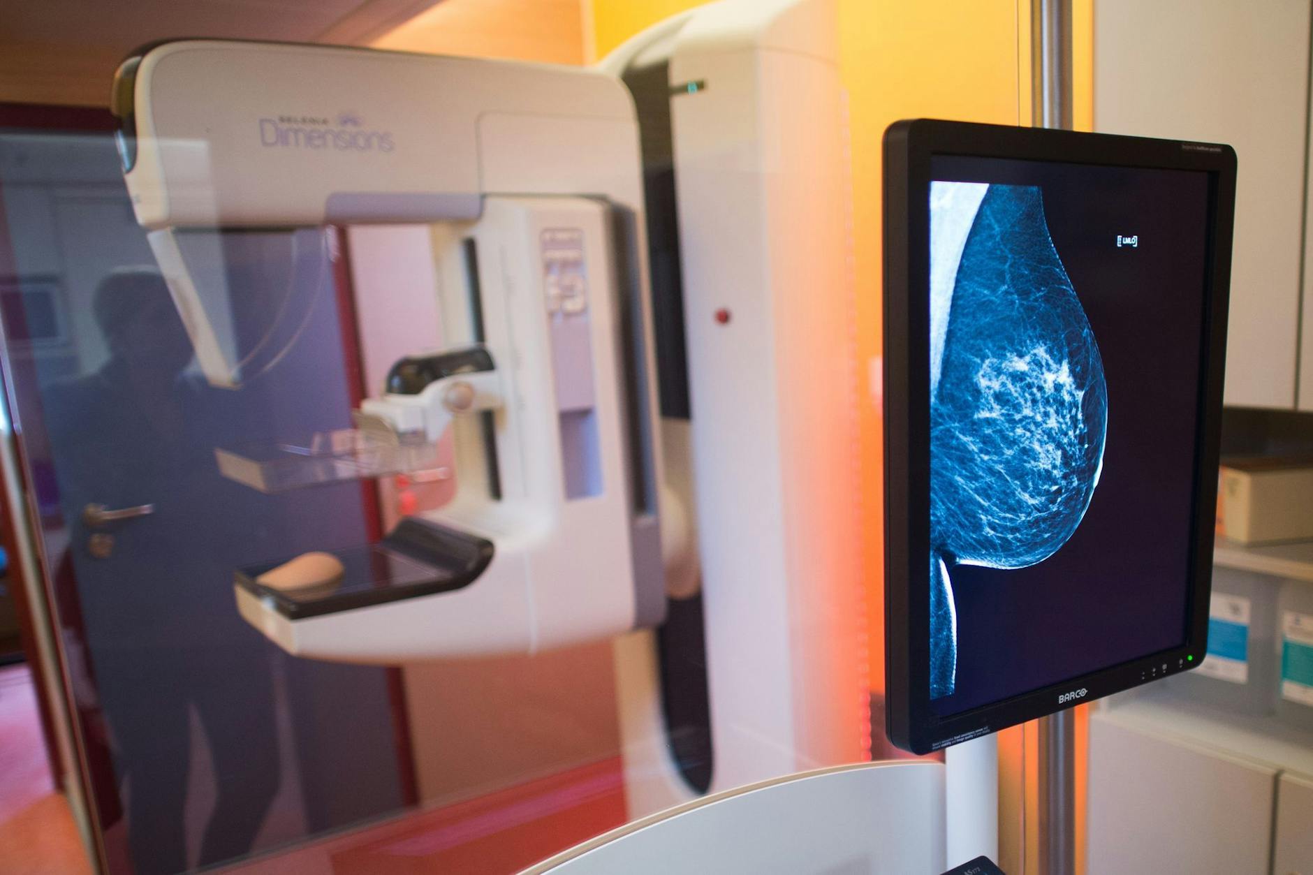 Röntgenaufnahme einer gesunden weiblichen Brust