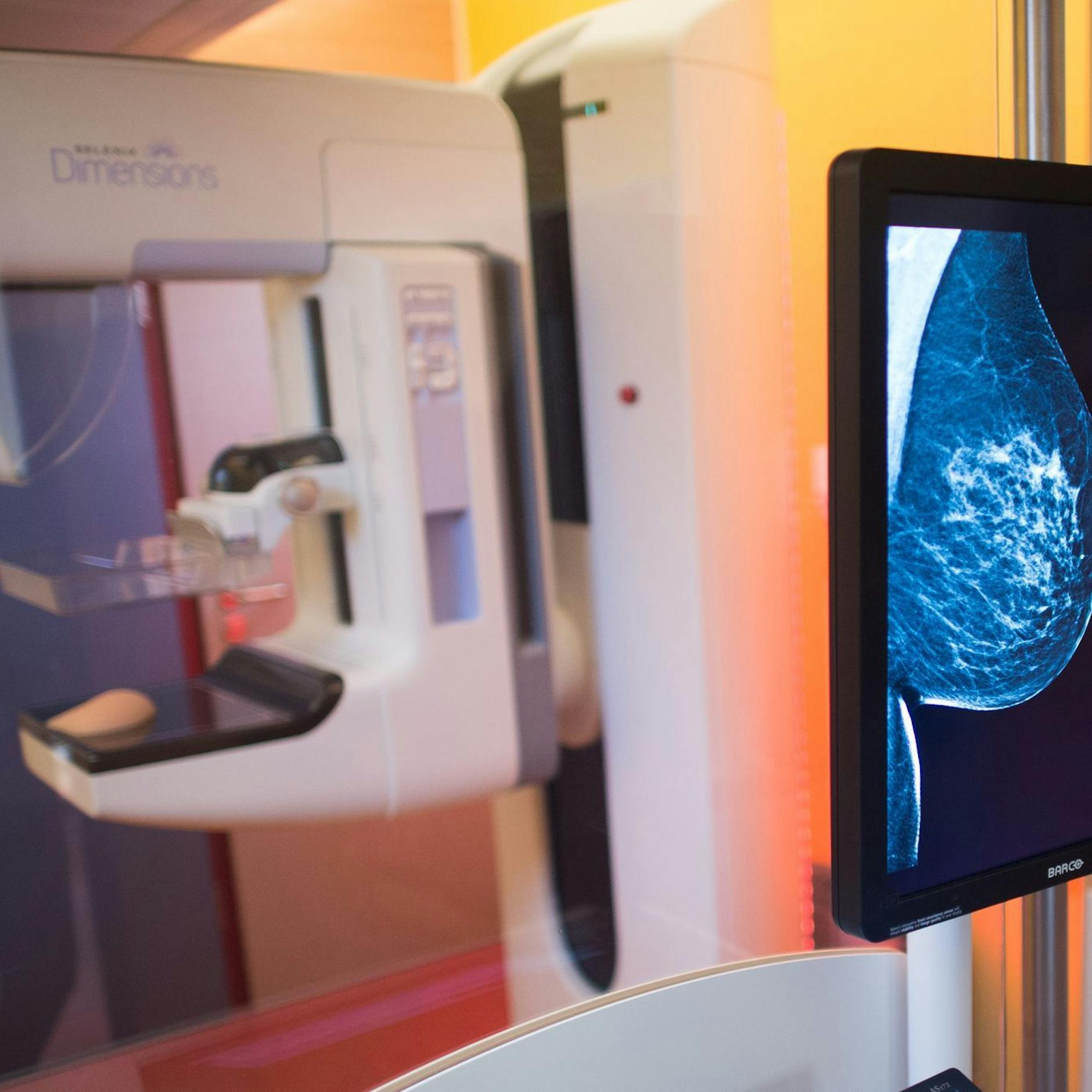 Image - Brustkrebs: Charité stellt vielversprechende Therapieansätze vor