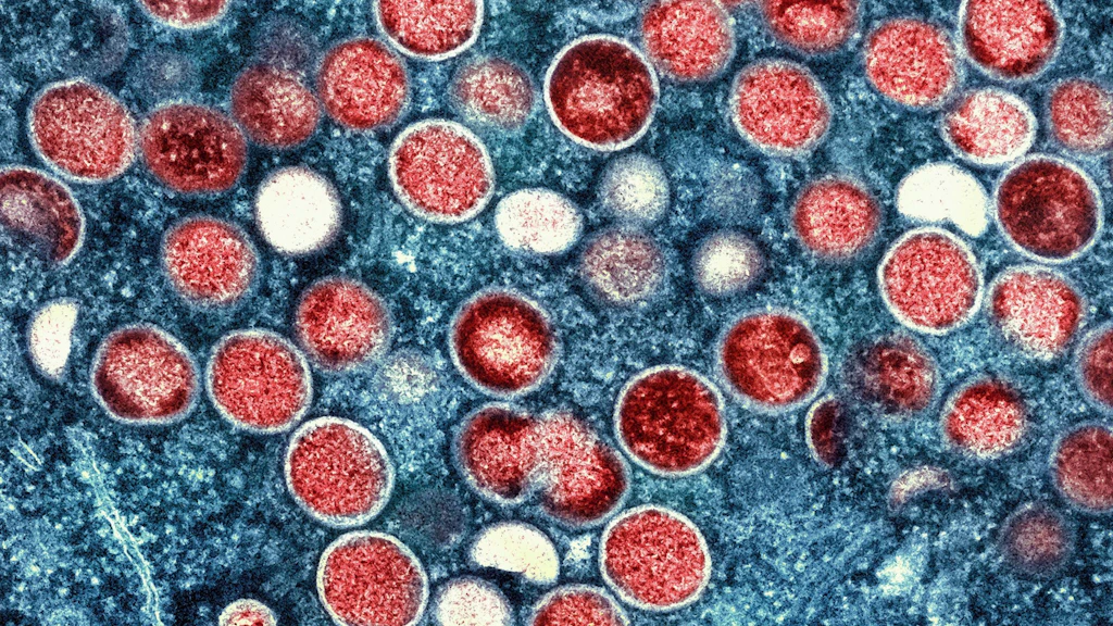 Kleine Zelle mal ganz groß fotografiert: Eine eingefärbte Mikroskopaufnahme von Mpox-Partikeln (rot) in einer infizierten Zelle (blau), die im Labor kultiviert wurde.