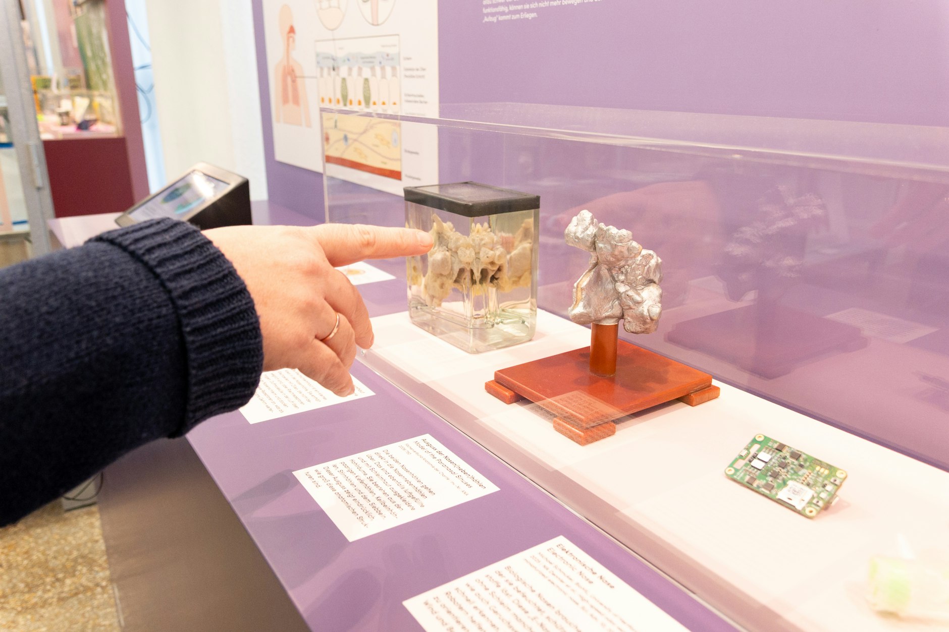 Ein Ausguss der Nasennebenhöhlen, sie sind komplett mit Schleimhaut ausgekleidet.