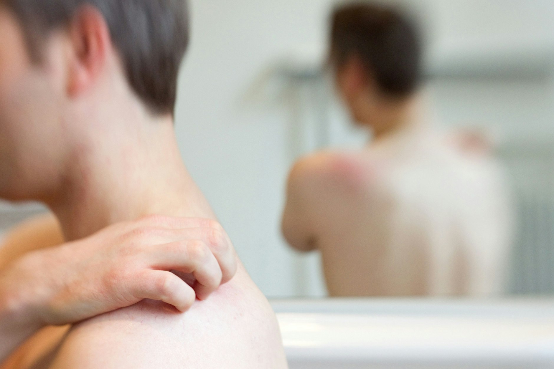 Ein Mann kratzt sich an der Schulter: Hautbläschen und Juckreiz sind typische Symptome der Gürtelrose.