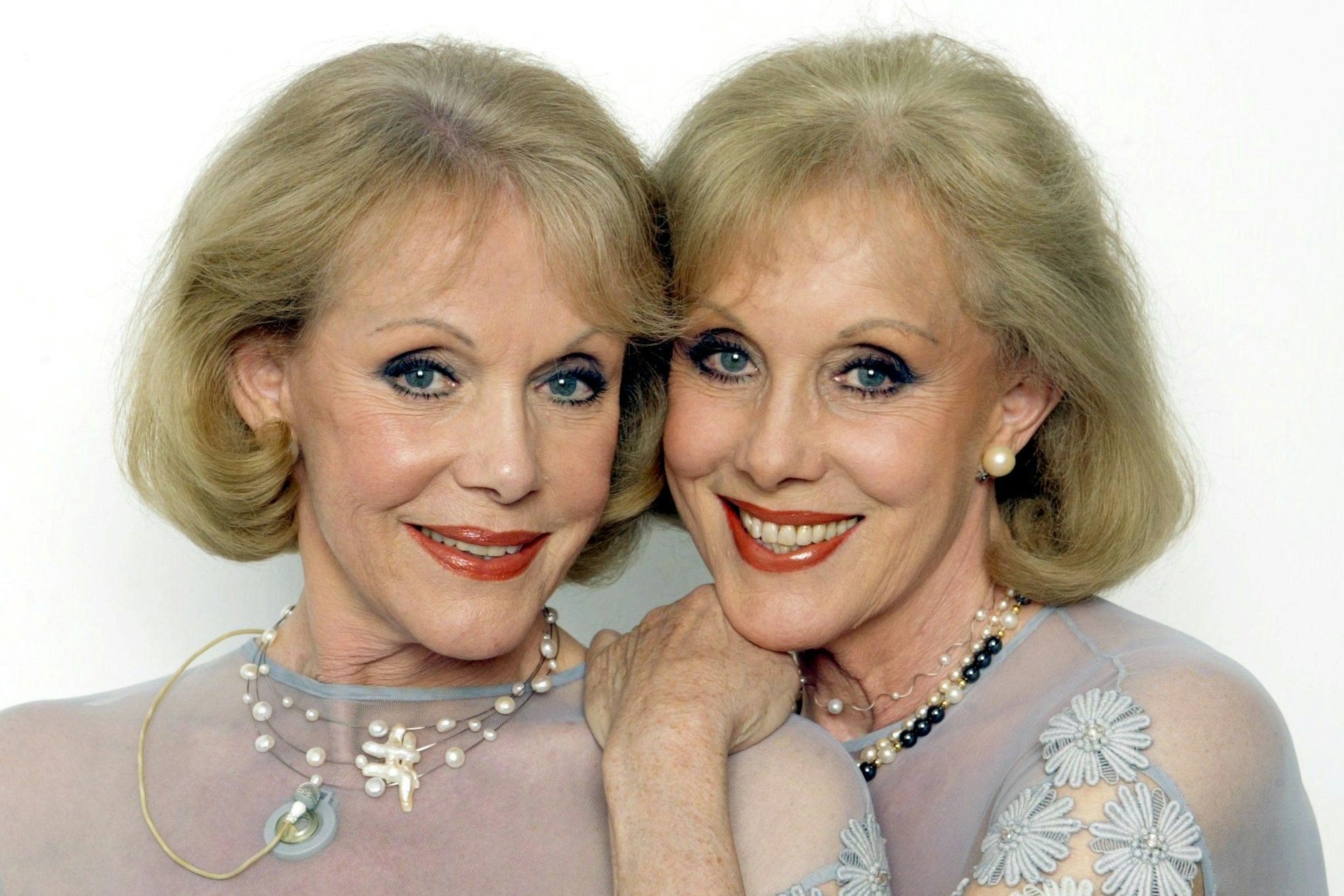 Sie verbrachten ihr Leben gemeinsam, gingen nun auch gemeinsam in den Tod: die Kessler-Zwillinge.