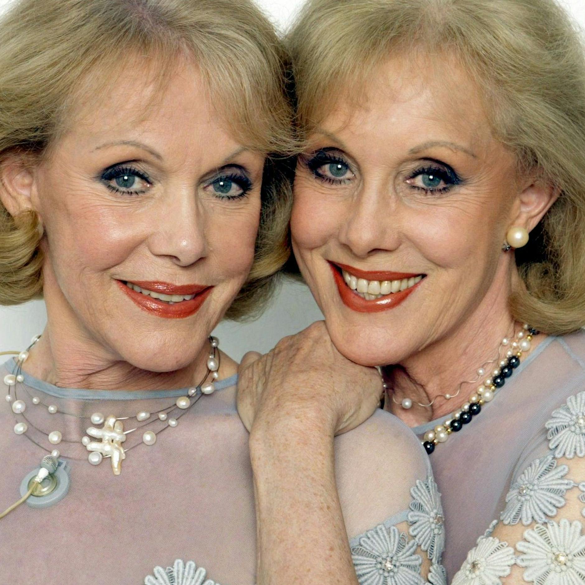 Patrick Lindner trauert um Kessler-Zwillinge: „Die beiden waren legendär“