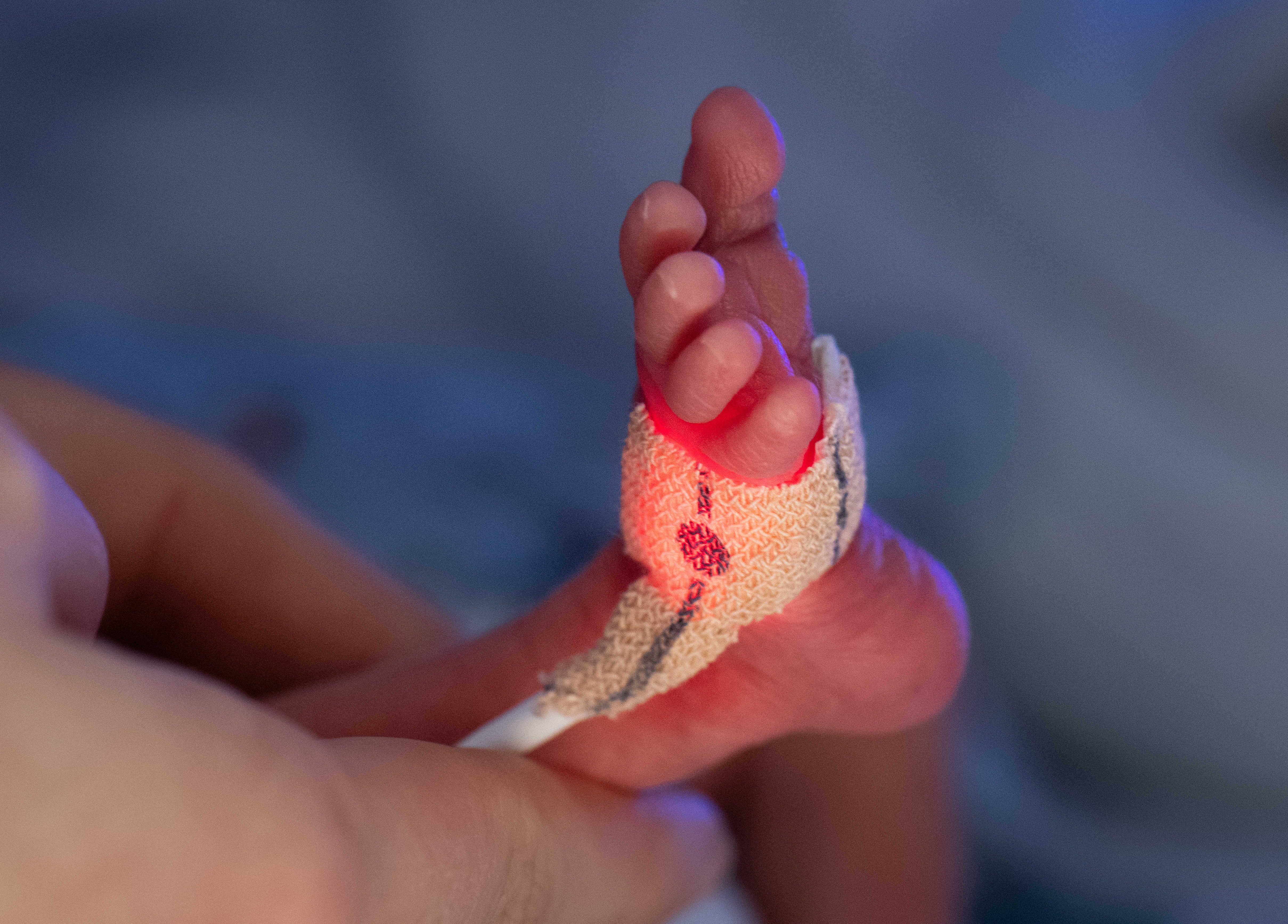 Frühchen in Berlin: Deshalb feiert das Sana-Klinikum Lichtenberg