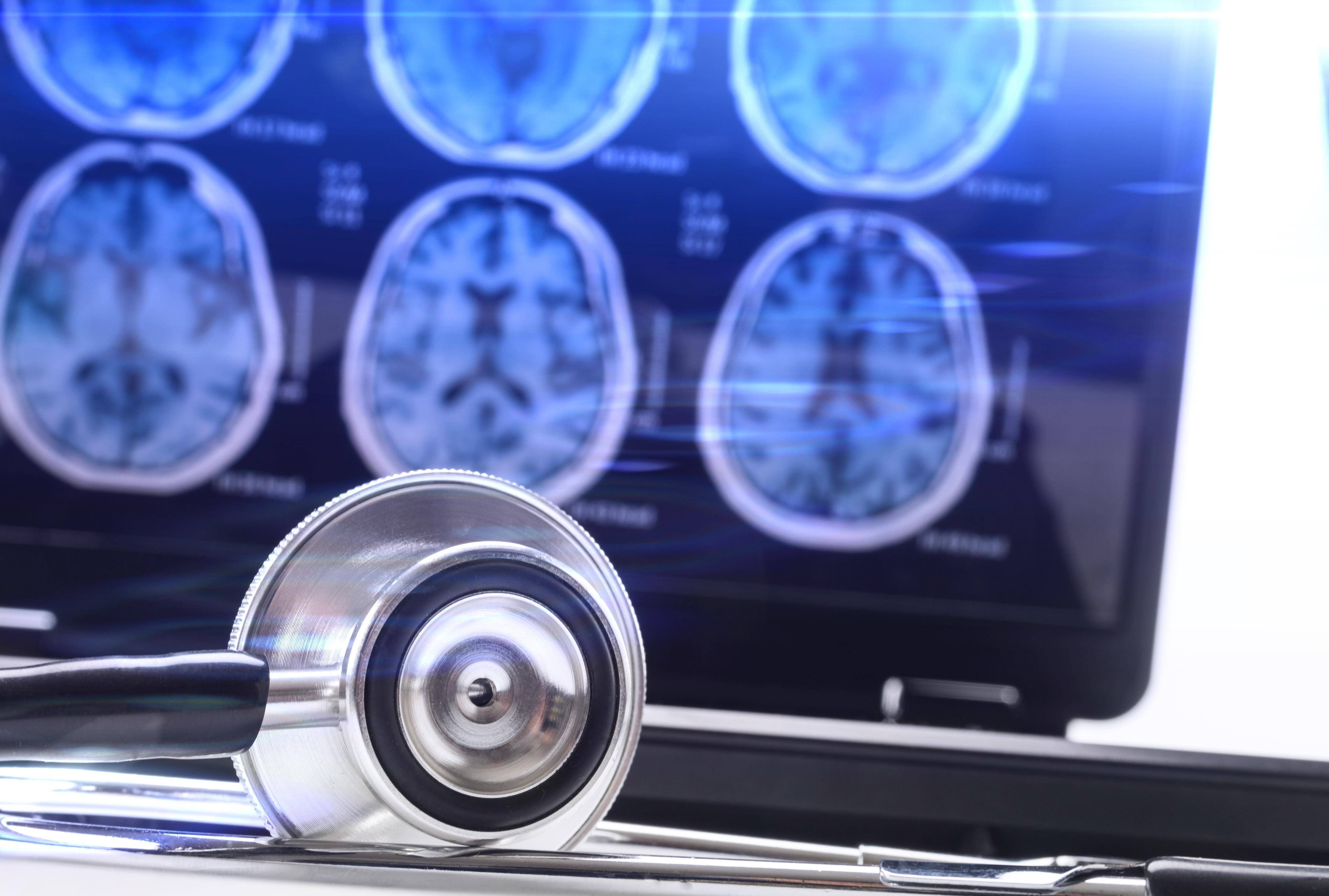 Erwachsen erst ab Anfang 30: Wissenschaftler ermitteln vier Phasen der Gehirn-Entwickung