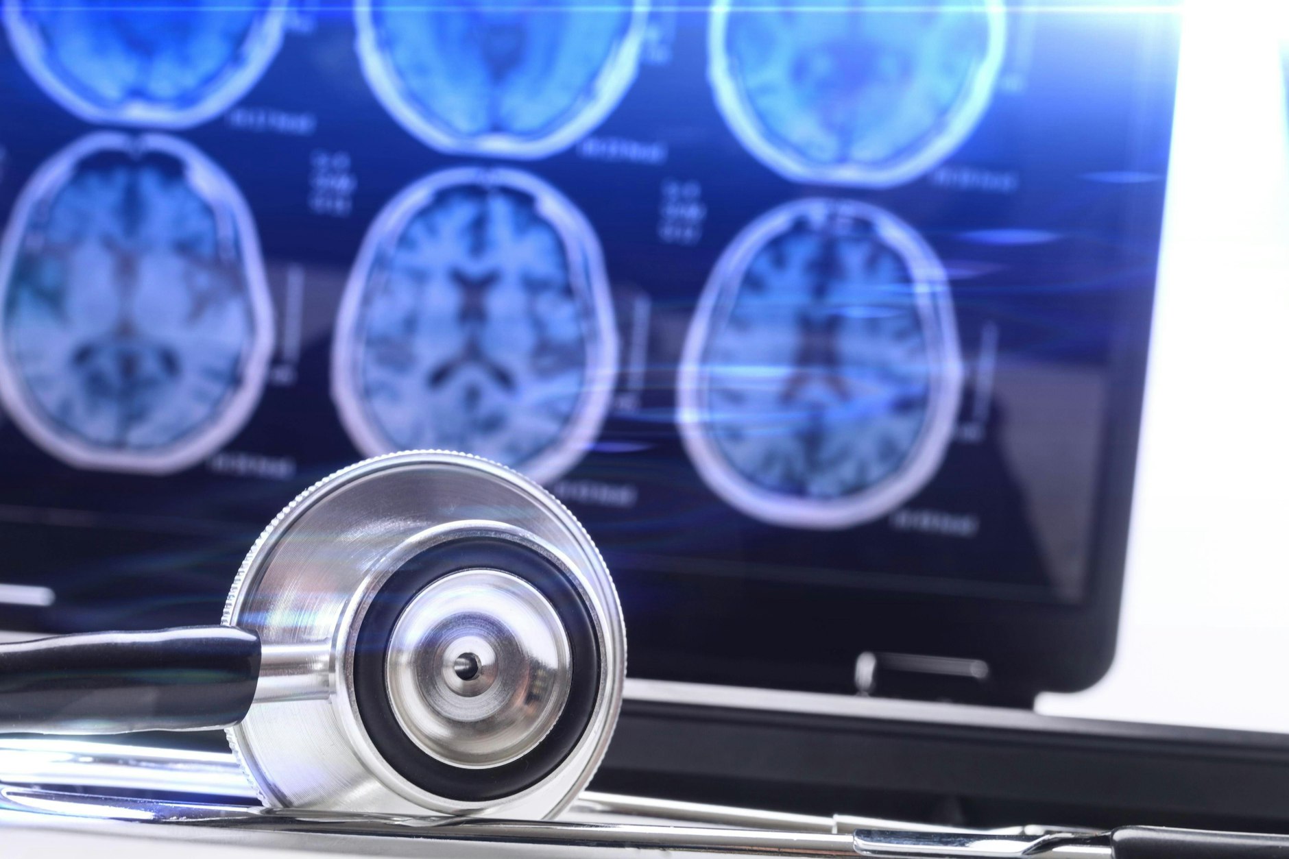 Stethoskop neben einem Computer mit Röntgenaufnahmen des Gehirns.