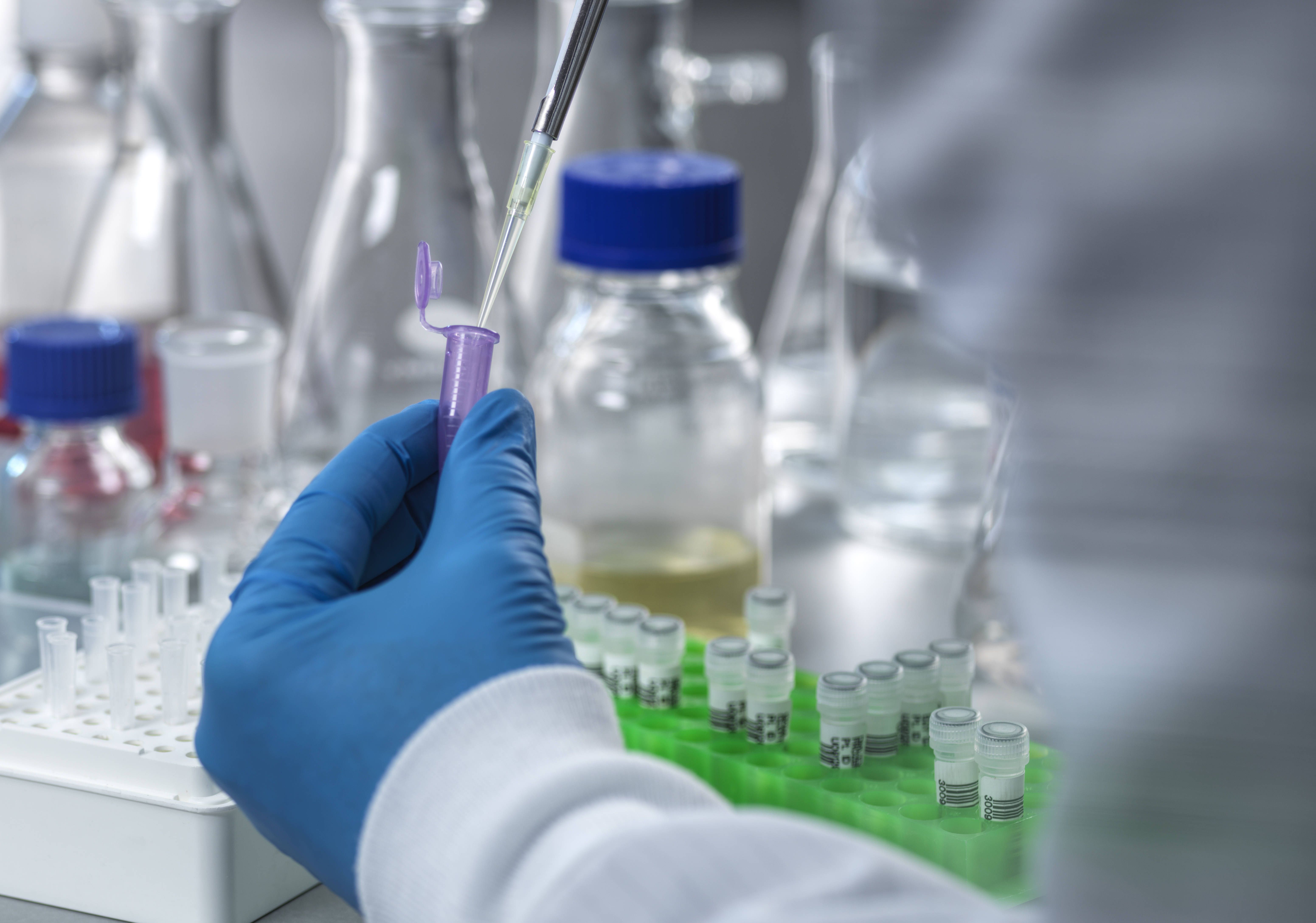 Image - Risiko für Mutationen: Forscher finden Schwachstelle in unserer DNA