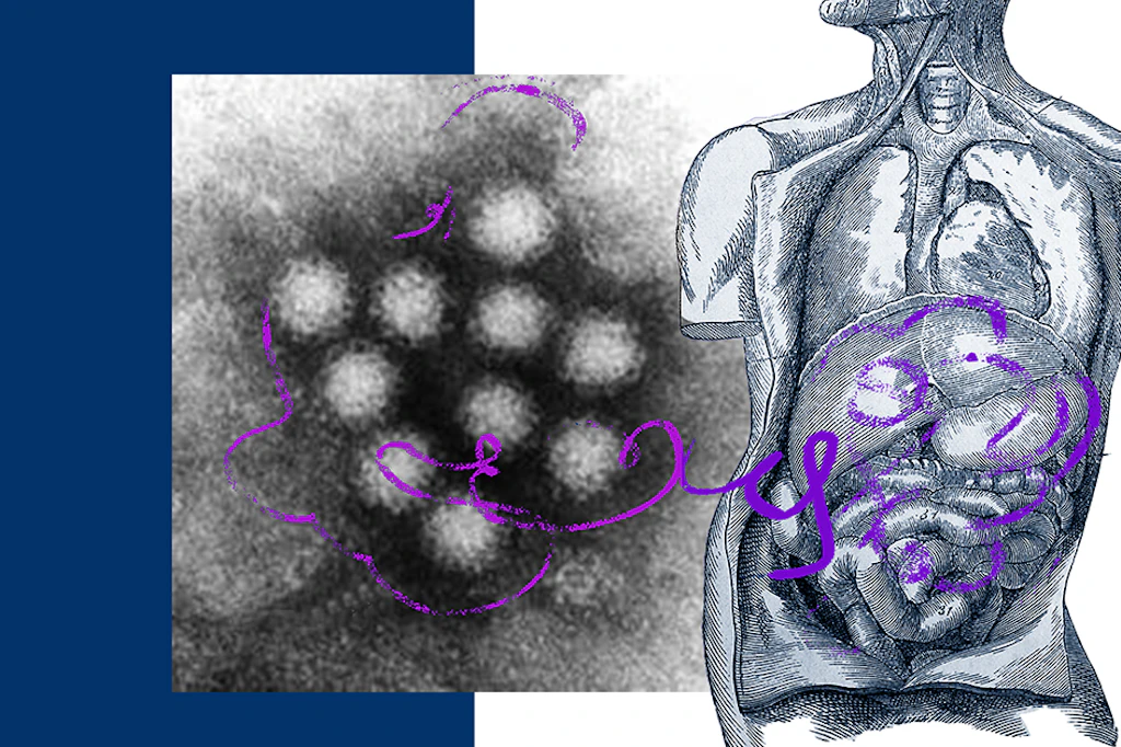 Norovirus in Berlin auf dem Vormarsch: Beginnt jetzt eine heftige Winterwelle?