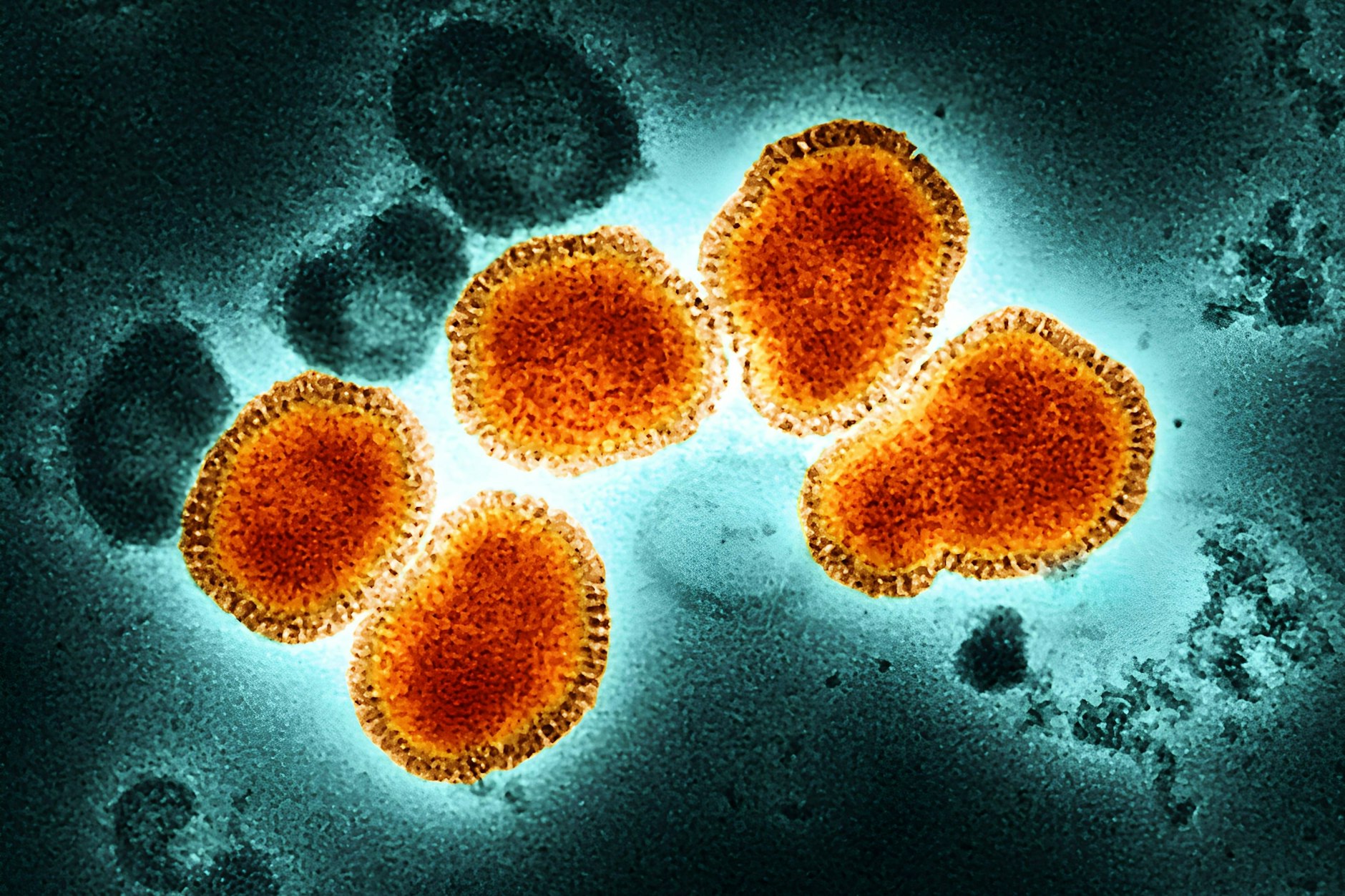 Diese Influenza-Viren treiben die aktuelle Grippewelle in Berlin an.