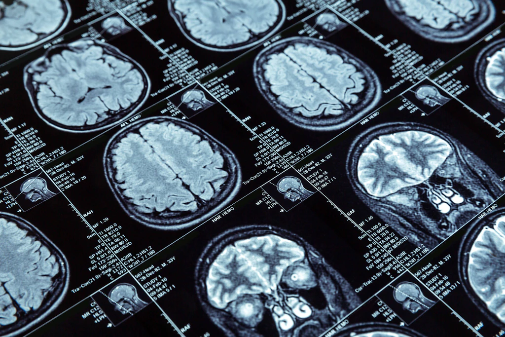 Alzheimer-Forschung: Immunenzym könnte Tau-Bildung im Gehirn steuern– neuer Therapieansatz?