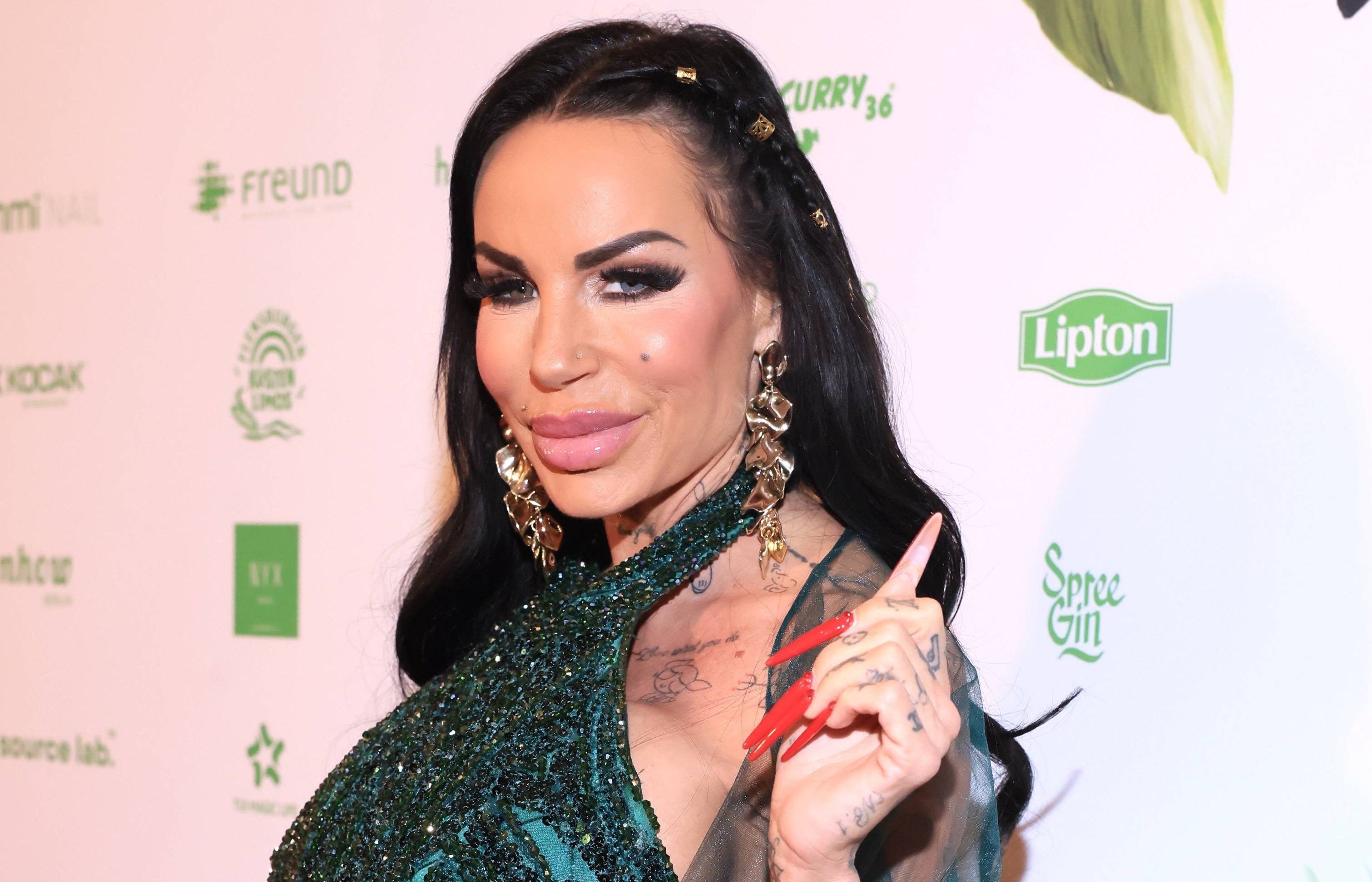 Gina-Lisa mit Arzt bei Event – „Wurde verpfuscht, bin fast gestorben“