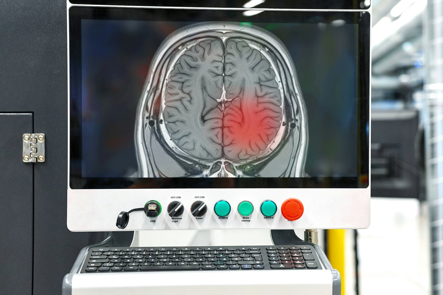 Die rot markierte Stelle im MRT-Bild des Gehirns könnte auf einen Hirntumor hinweisen.