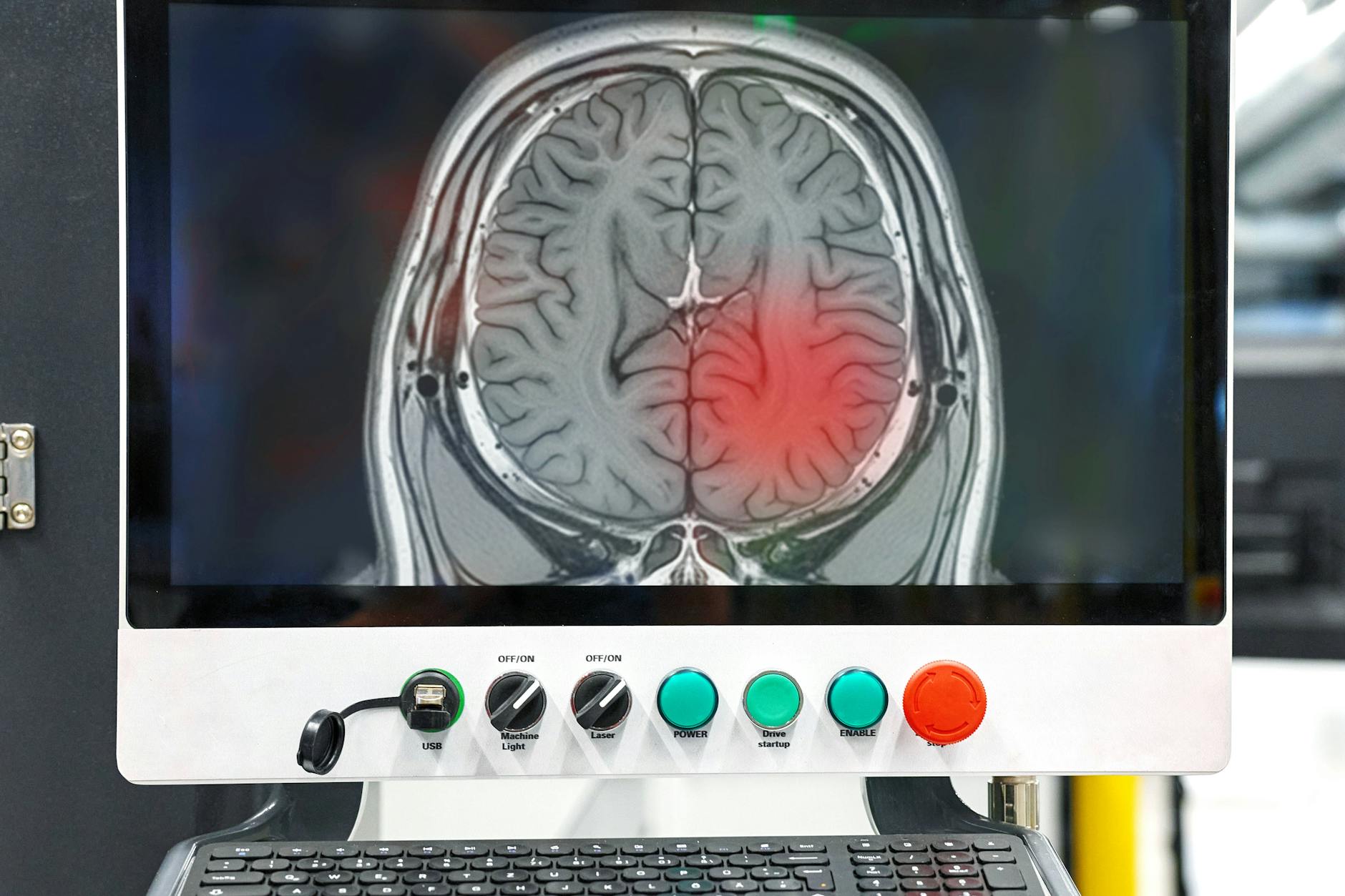 Krebs trifft fast jeden Zweiten in Deutschland