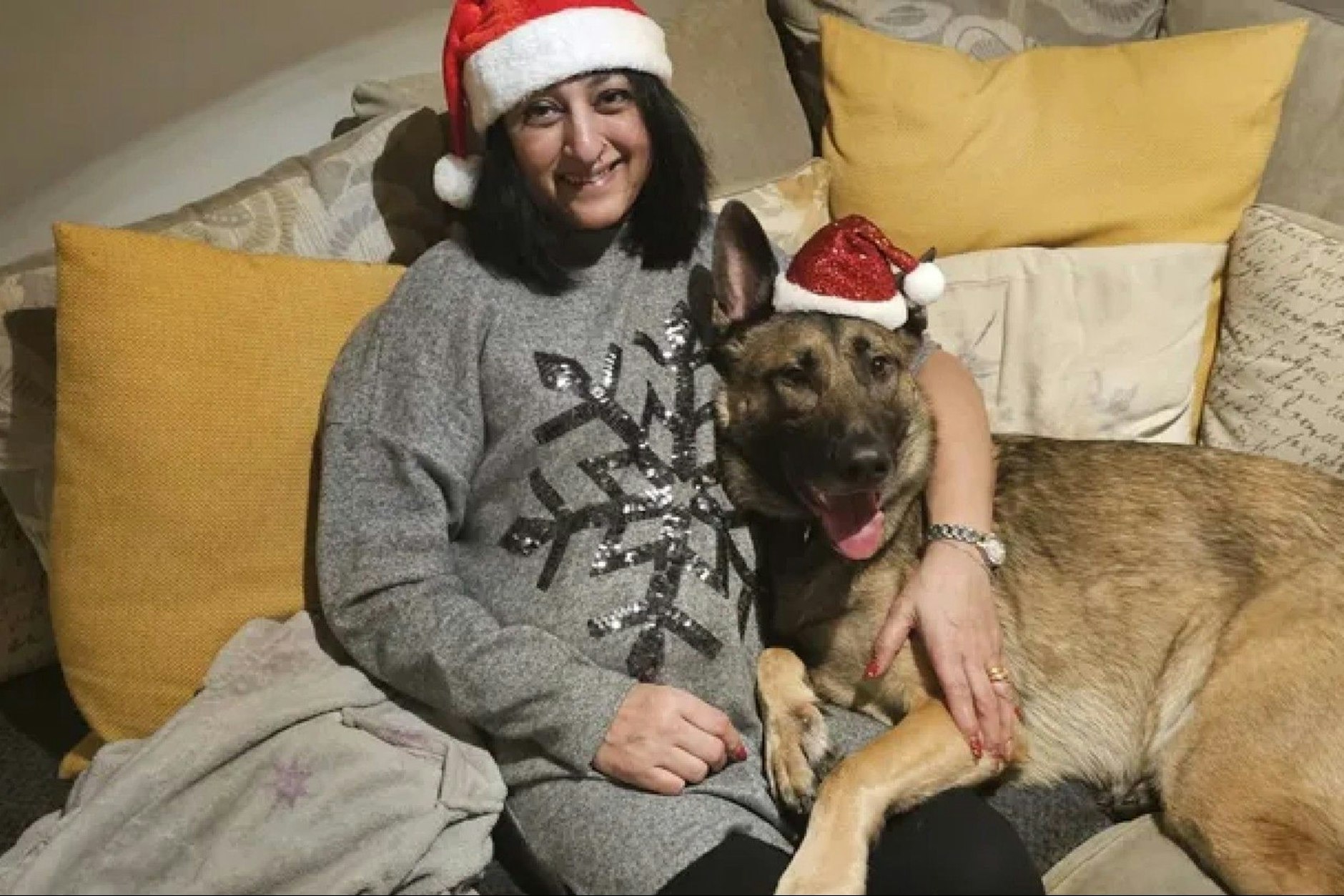 Manjit Sangha erlitt nach dem Spielen mit ihrem Hund eine Sepsis, vermutlich ausgelöst durch den Speichel des Tieres.