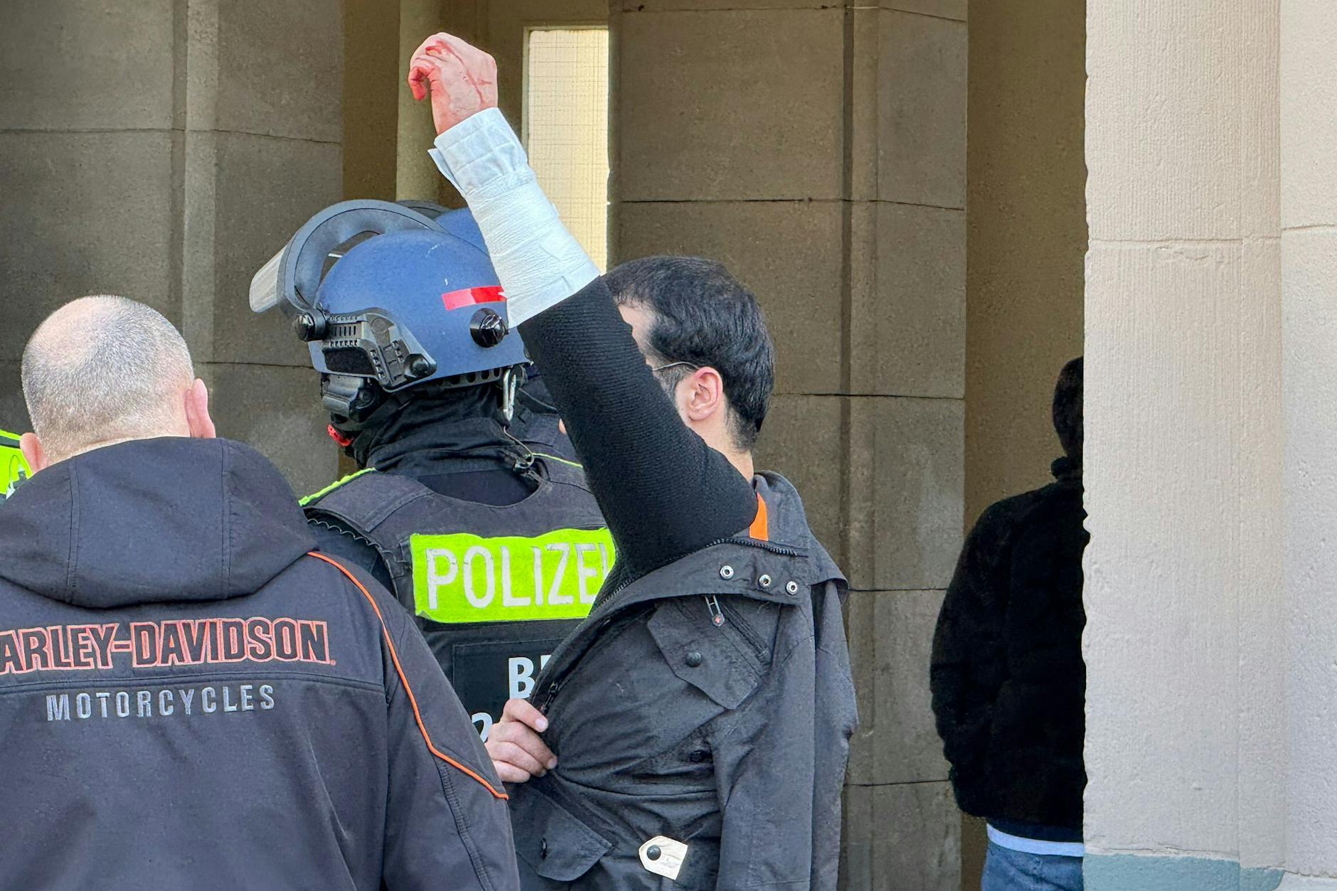 Der Sicherheitsmitarbeiter wurde vom Täter an der Hand verletzt.