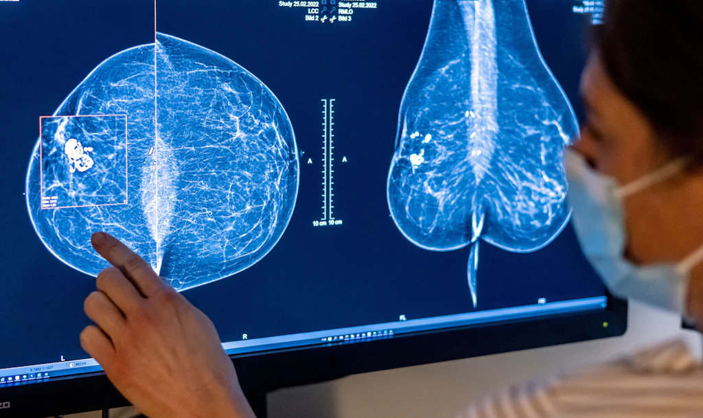 Krebs überlebt, aber nicht gesund? Ein Charité-Programm macht Patientinnen jetzt Hoffnung