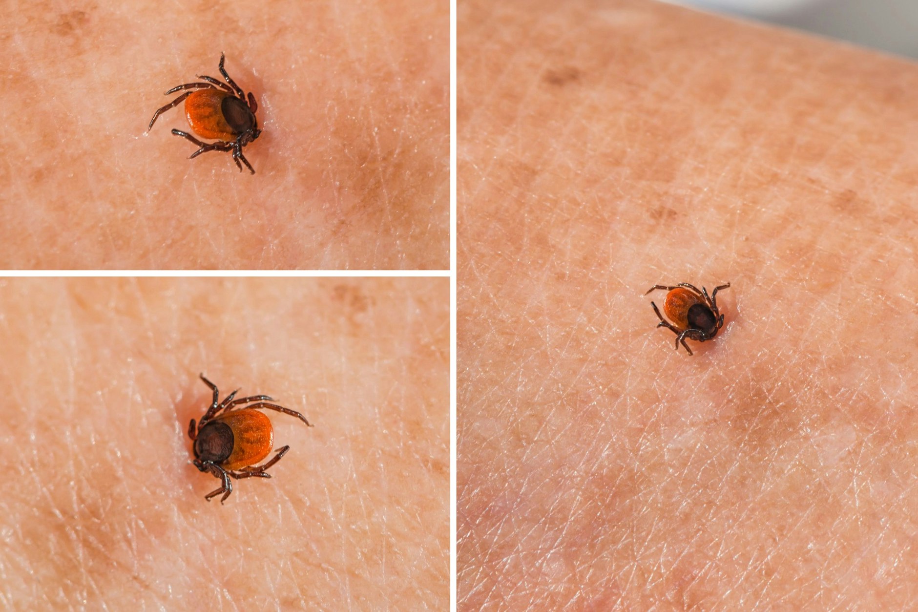 Zecken beißen schnell zu – sie müssen dann besonders vorsichtig wieder entfernt werden.