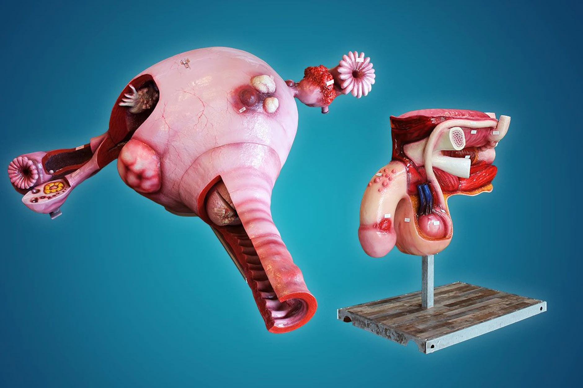Zum Tag des Gesundheitsamtes werden im Kulturpalast Dresden solche Modelle ausgestellt. Die Gebärmutter ist sieben Meter lang und kann von innen besichtigt werden. Da wirkt der zwei Meter große Penis fast klein.