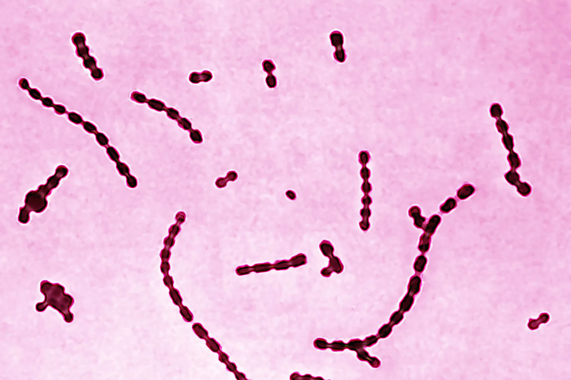 Streptococcus pyogenes, dessen Erbgut aus dem Zahn einer präkolumbischen Mumie rekonstruiert wurde, unter dem Mikroskop