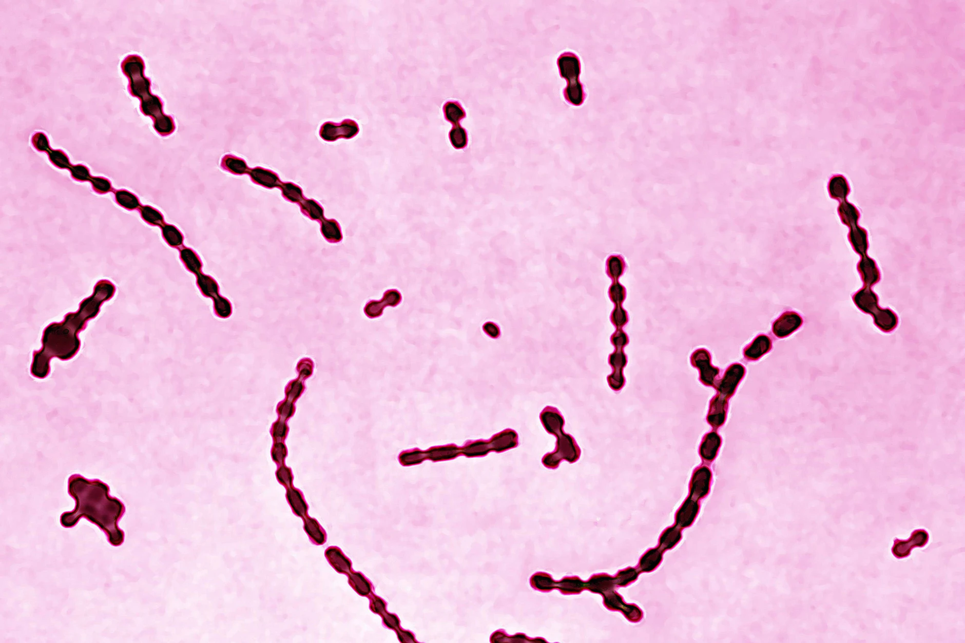 Streptococcus pyogenes, dessen Erbgut aus dem Zahn einer präkolumbischen Mumie rekonstruiert wurde, unter dem Mikroskop