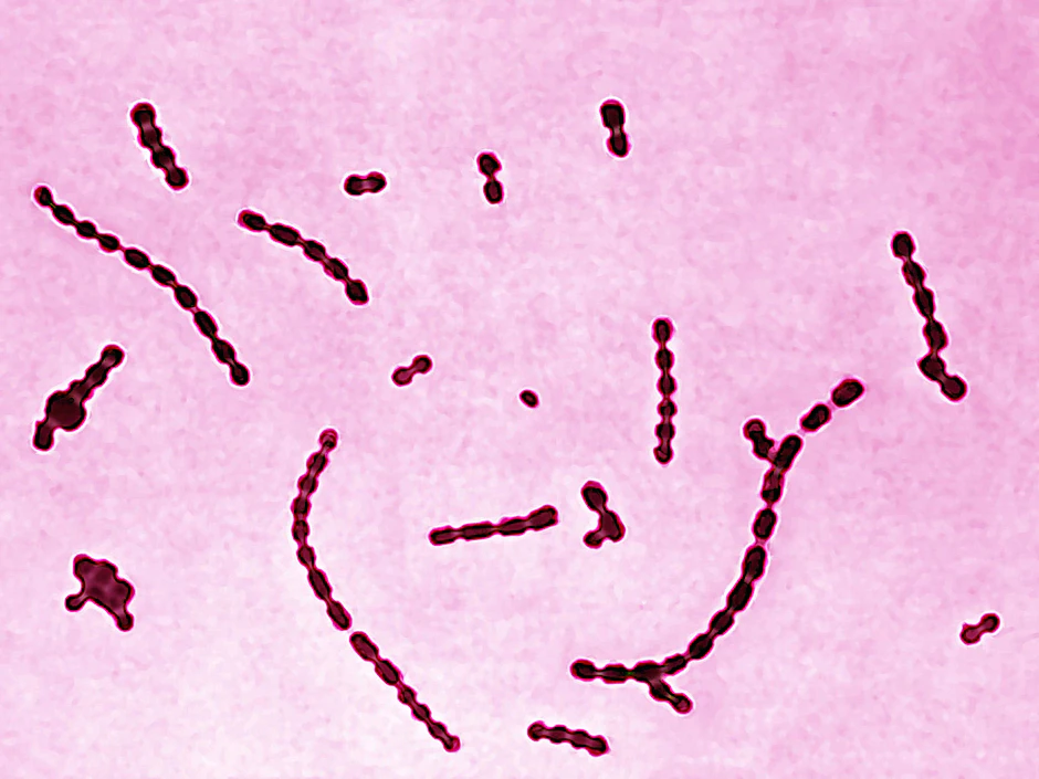 Streptococcus pyogenes, dessen Erbgut aus dem Zahn einer präkolumbischen Mumie rekonstruiert wurde, unter dem Mikroskop