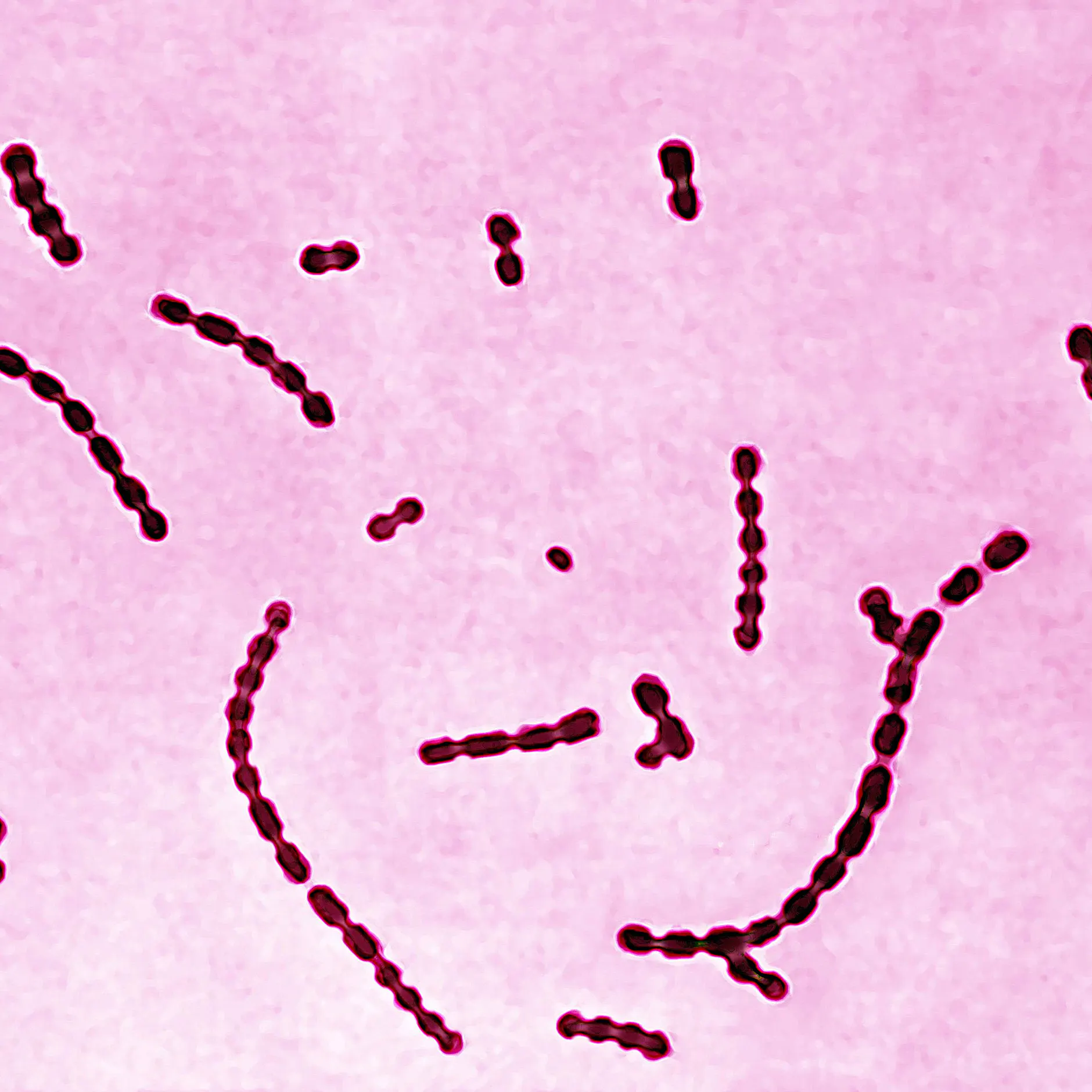 Streptokokken in bolivianischer Mumie: Erreger war vor Kolumbus in Amerika