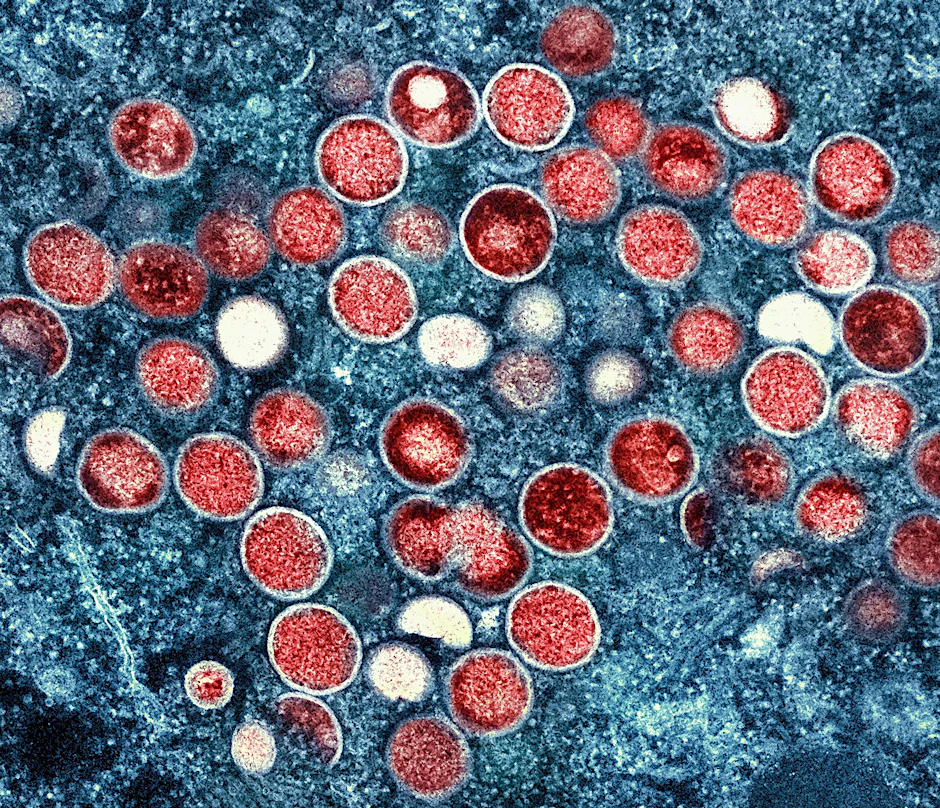 Eine eingefärbte Mikroskop-Aufnahme von Mpox-Partikeln in einer infizierten Körperzelle.