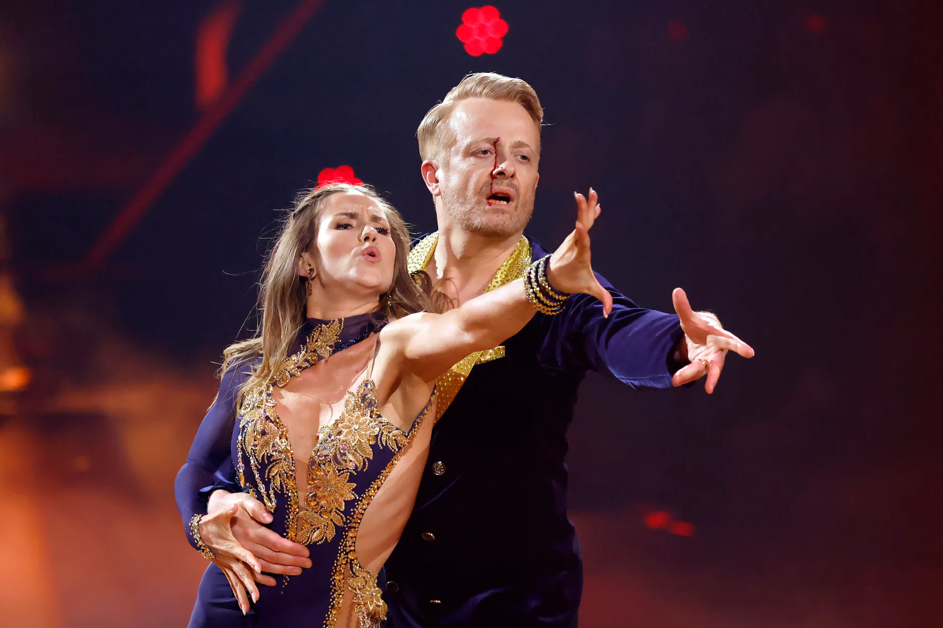 Entertainer Ross Antony lässt sich nichts anmerken und tanzt blutend mit Mariia Maksina weiter.