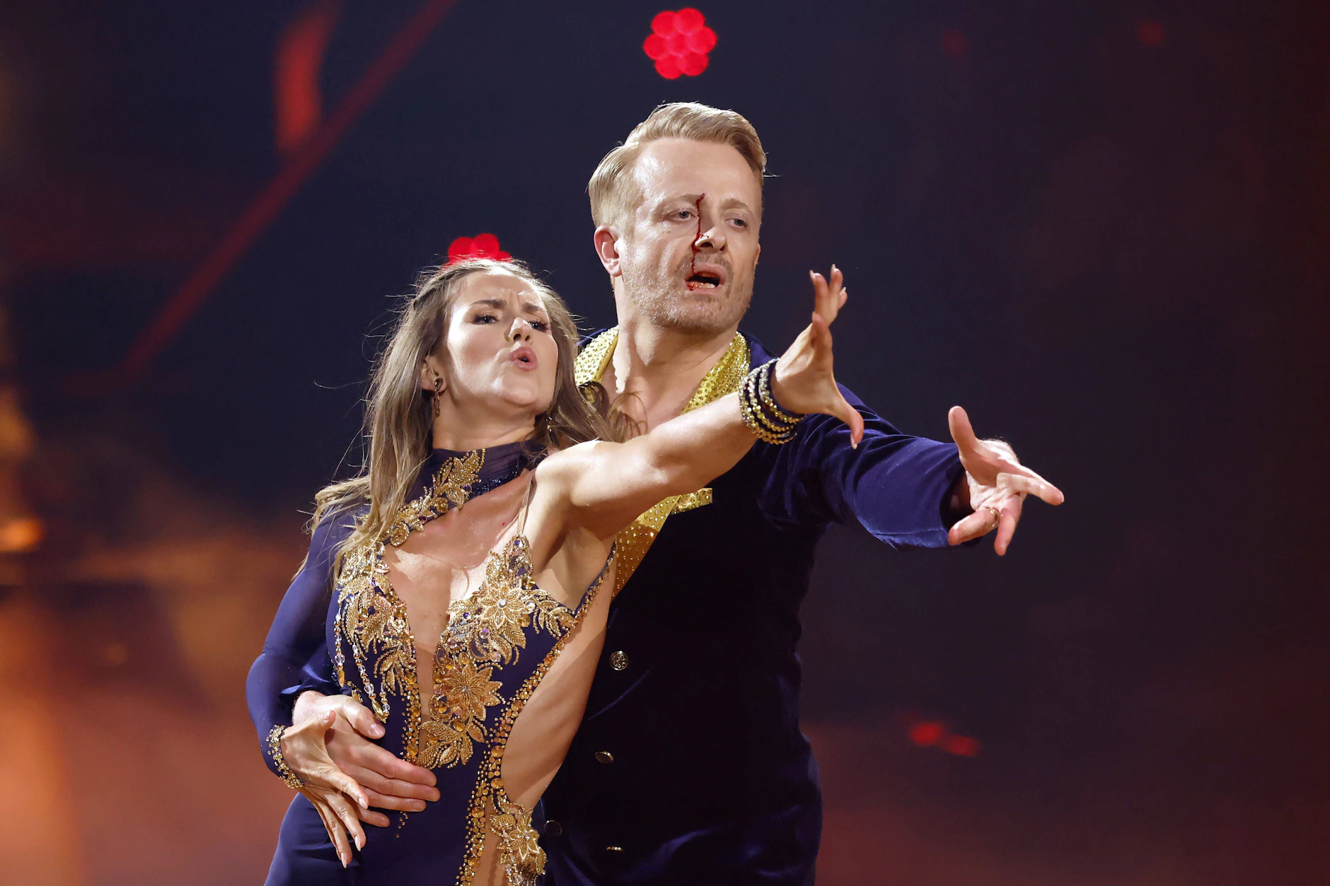 Entertainer Ross Antony lässt sich nichts anmerken und tanzt blutend mit Mariia Maksina weiter.