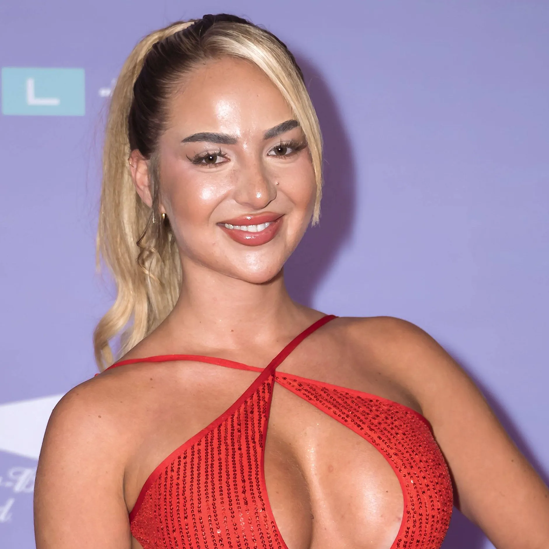 Bitter! Emma Fernlund verrät den wahren Grund für ihren Beauty-OP-Marathon