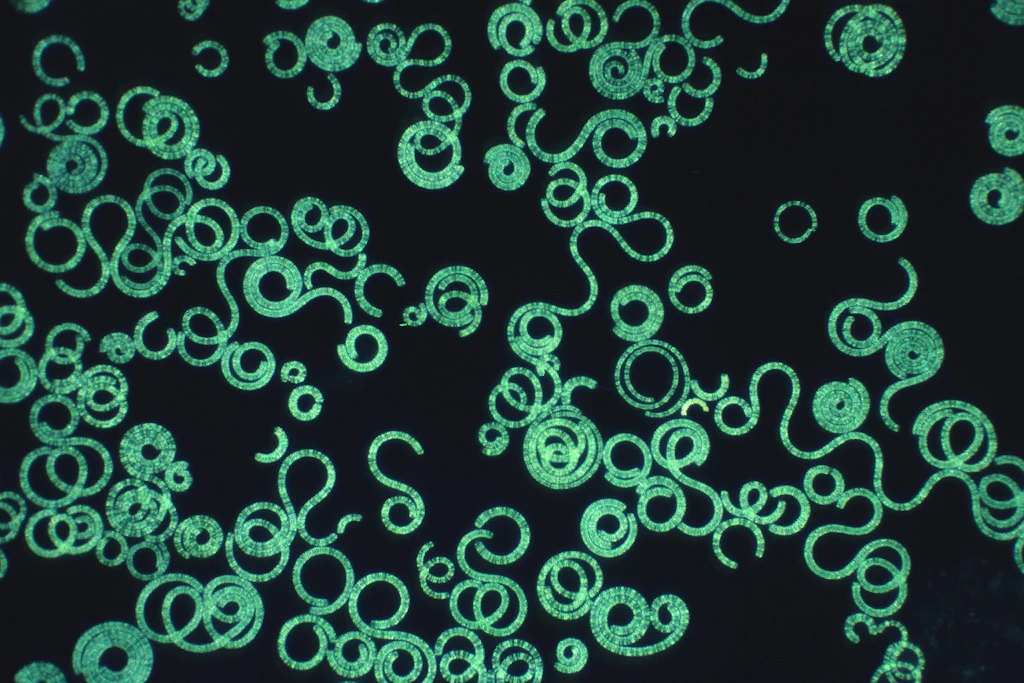 So sieht Spirulina unter dem Mikroskop aus.