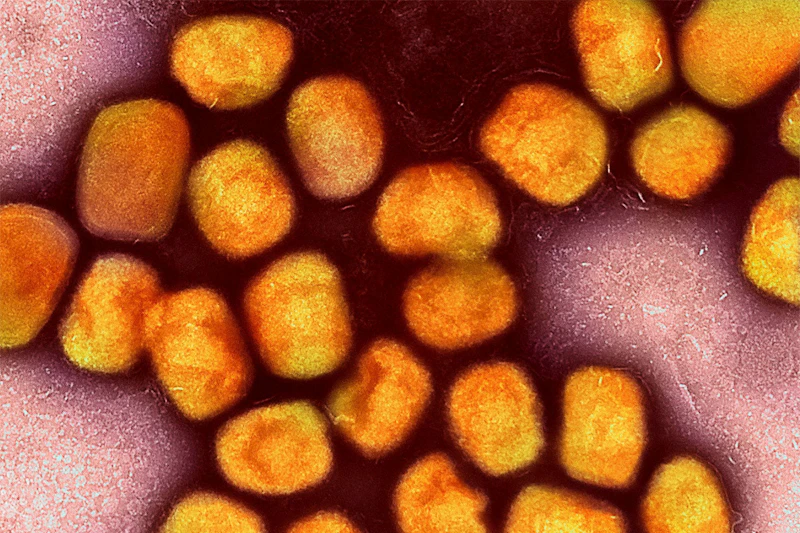 Neue Mpox‑Welle in Berlin – erstmals auch Frau infiziert