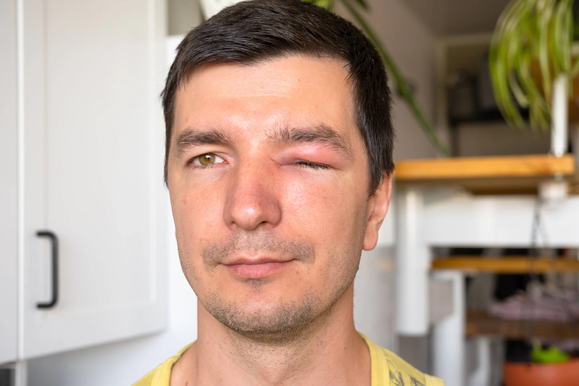 Jedes Jahr 20 Tote! Das gefährlichste Tier Deutschlands wird unterschätzt