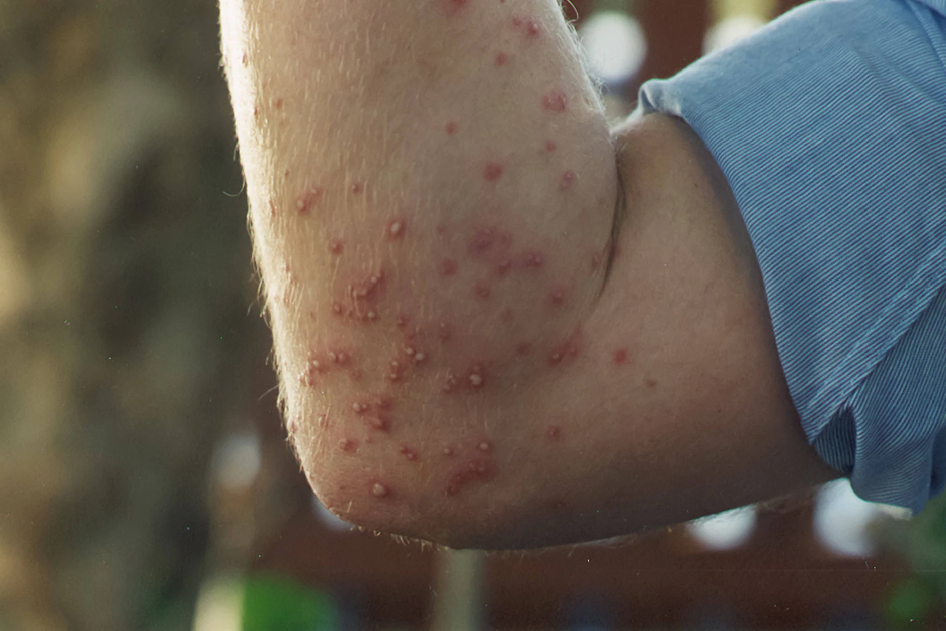 Invasive Ameisen breiten sich immer mehr in Deutschland aus und können auch für den Menschen gefährlich werden.