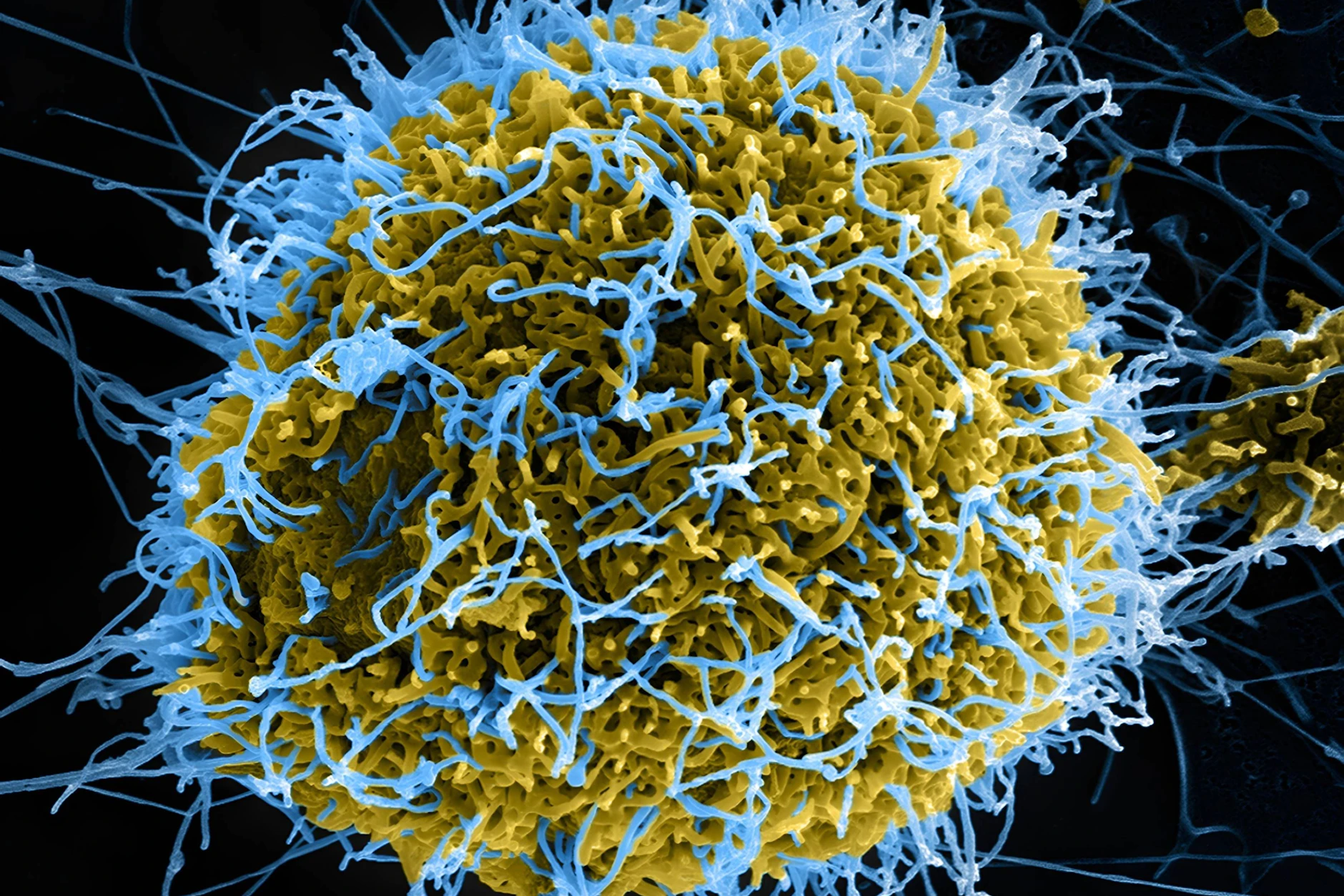 Das Ebola-Virus gilt als eines der gefährlichsten Viren der Welt und wird über Körperflüssigkeiten von Mensch zu Mensch weitergetragen.