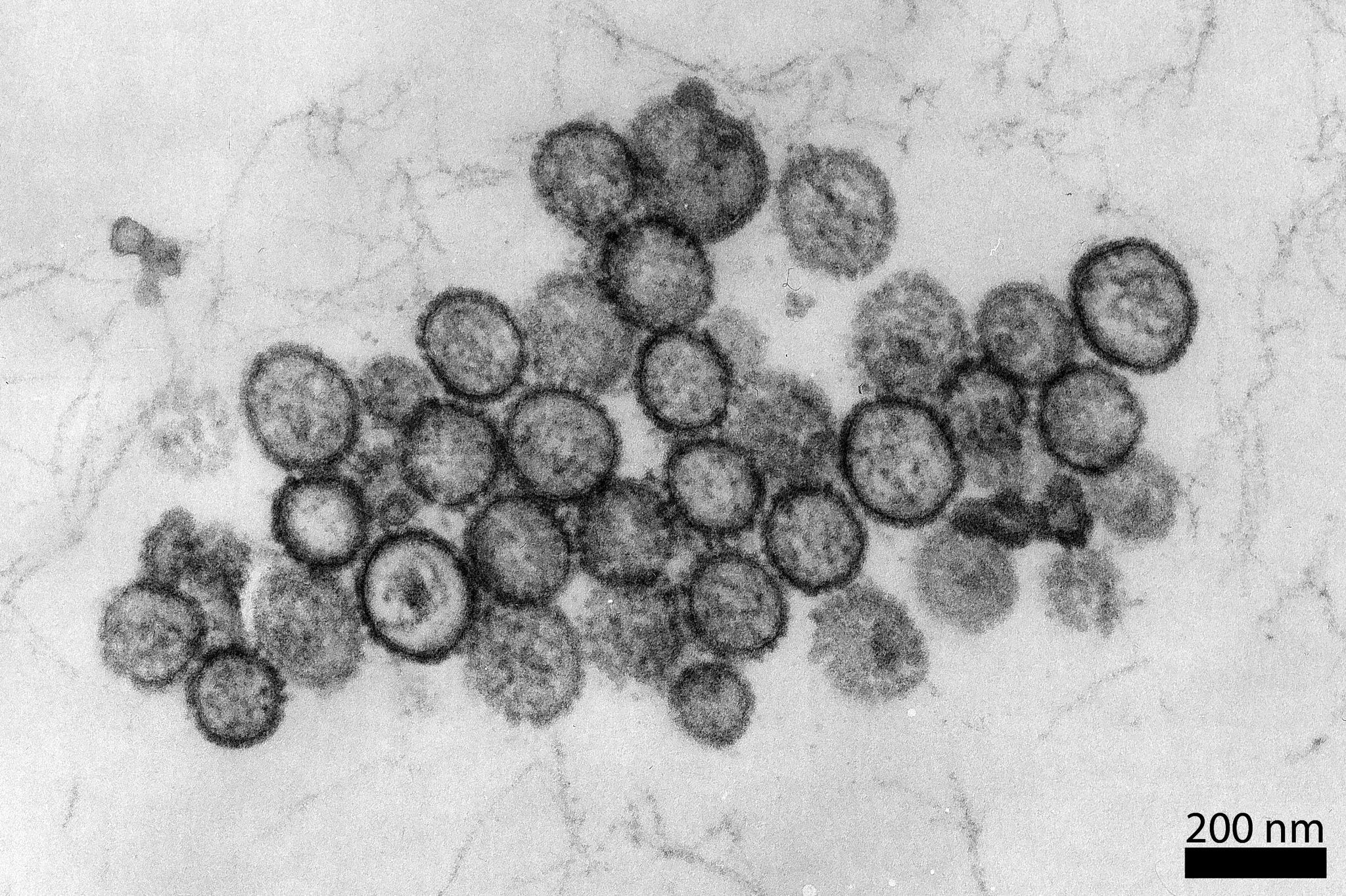 Reisender mit Hantavirus in Spanien isoliert: Die Lage im Überblick