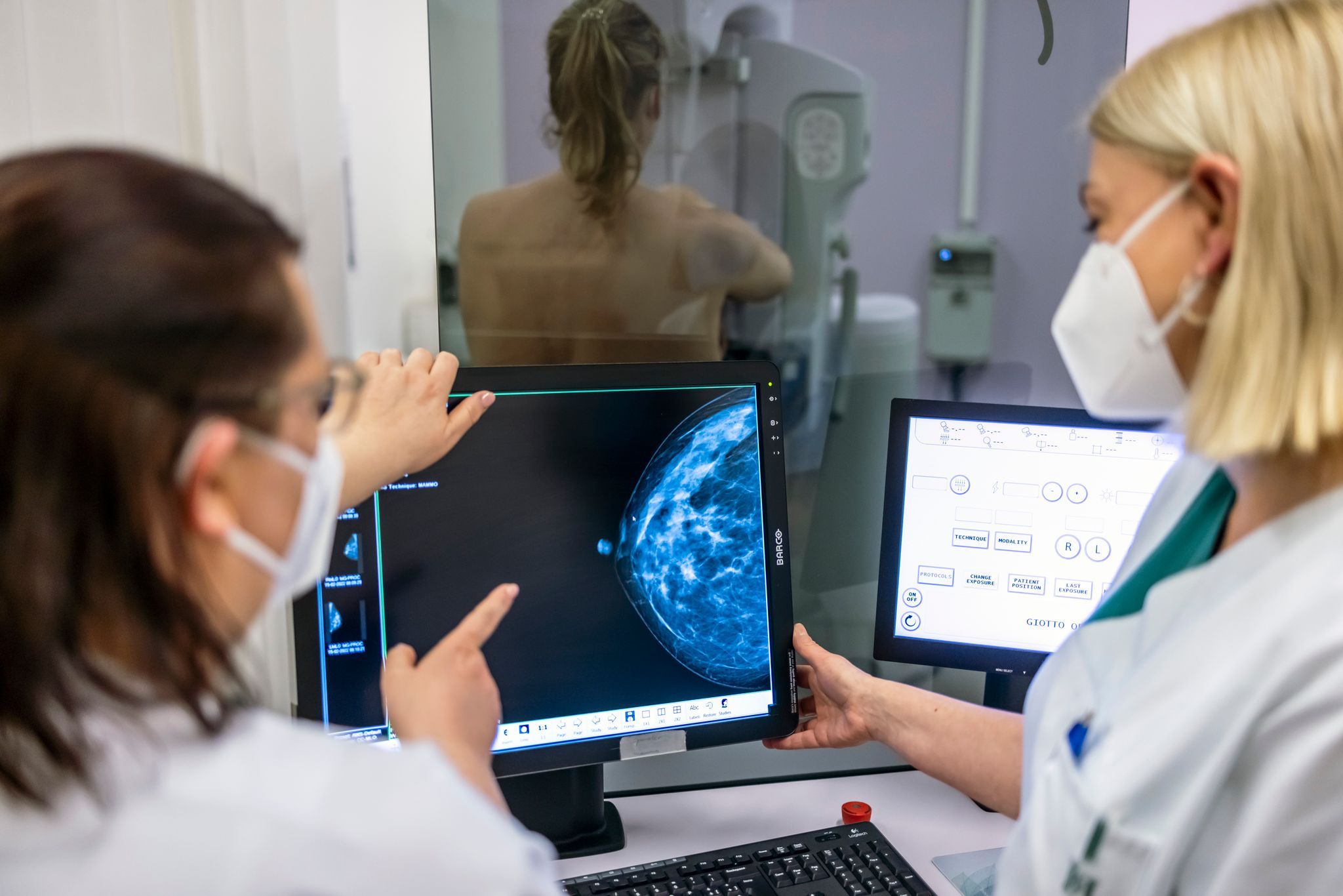 Brustkrebs behandeln ohne Chemo: Neue Studie macht Patientinnen Hoffnung