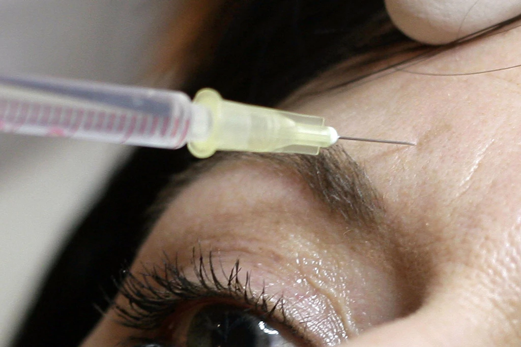 Eine junge Frau soll Kunden ohne Qualifikation Botox gespritzt haben.