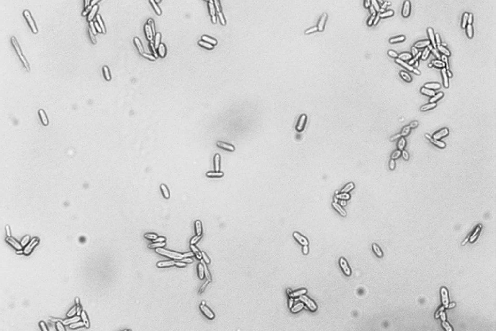 S. brasiliensis, Hefezellen in typischlänglicher Zigarrenform. Balken: 10 µm