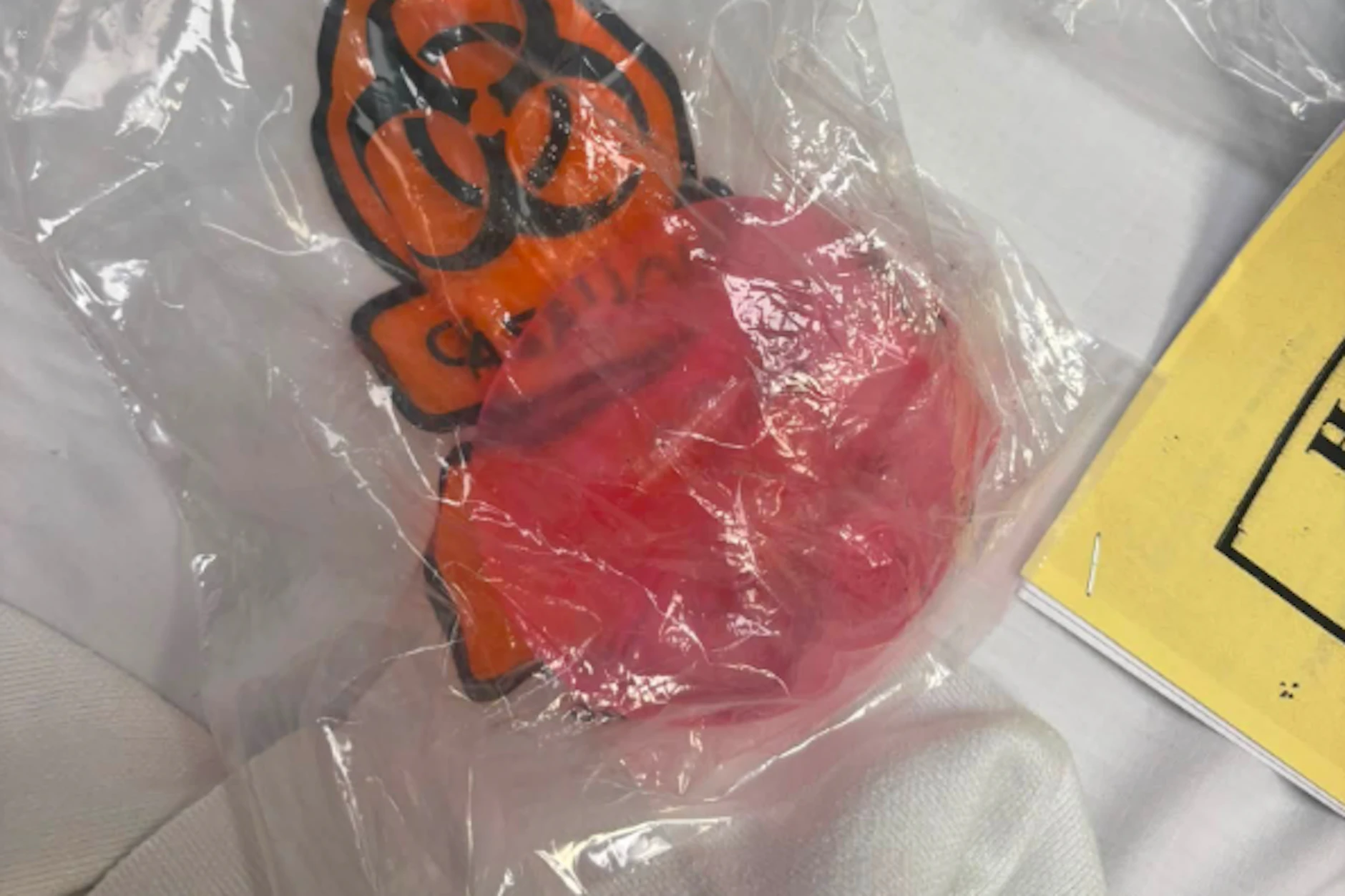 Das geplatzte Gel-Spielzeug, das die Verbrennungen verursachte.