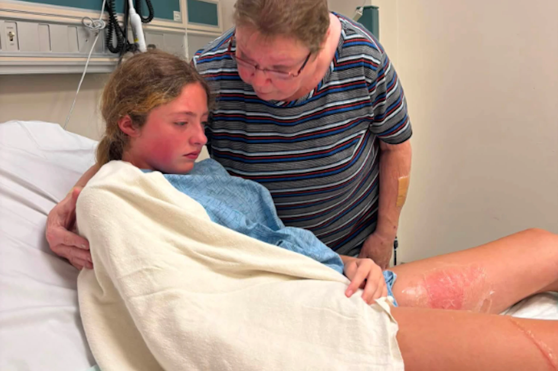 Teenager Natalee liegt im Krankenhaus, nachdem sie durch ein explodiertes Gel-Spielzeug Verbrennungen an den Beinen erlitten hat.
