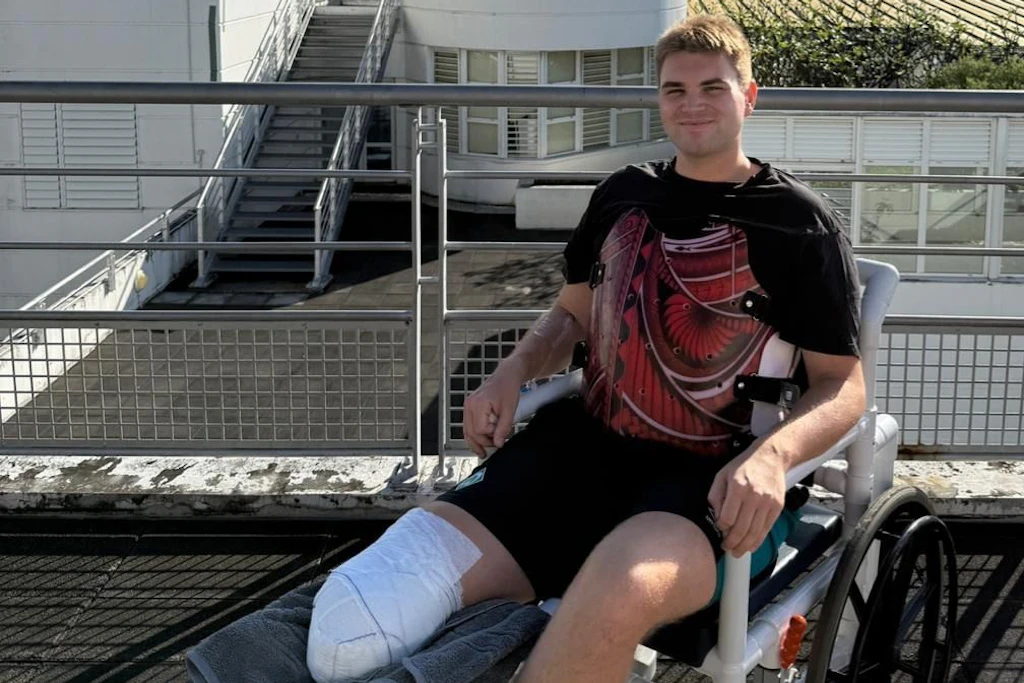 Brian hat bei einem Tauchunfall sein Bein verloren.