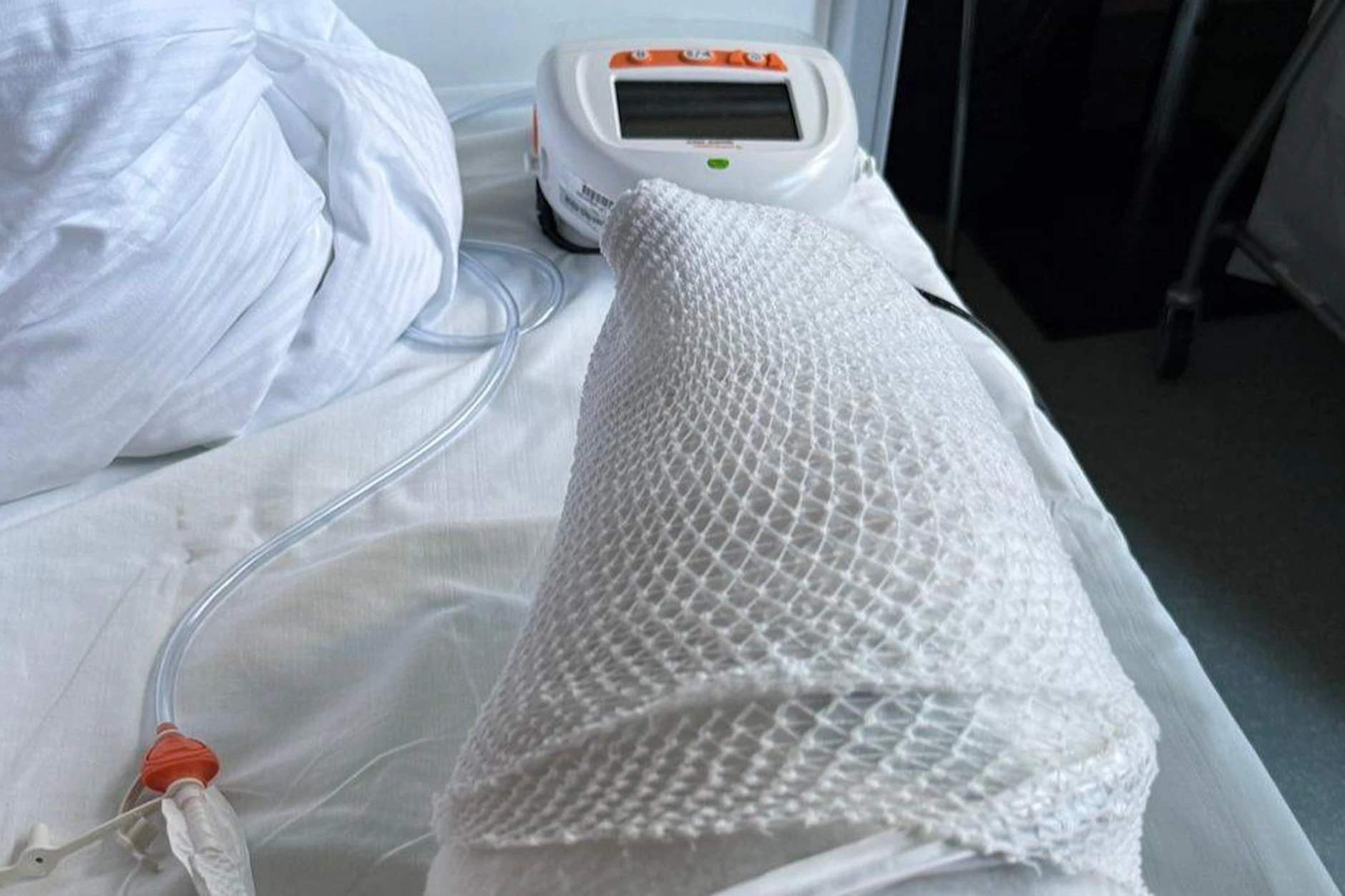Als Brian nach der Operation aufwachte, blieb von seinem Bein nur ein Stumpf über.
