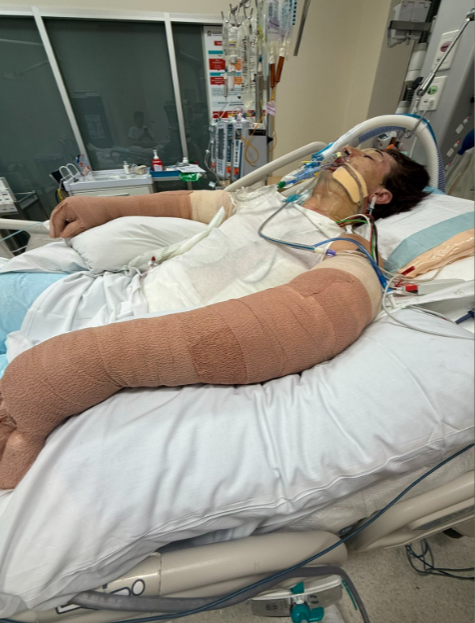 Saugroboter explodiert! 25-Jähriger kämpft um sein Leben