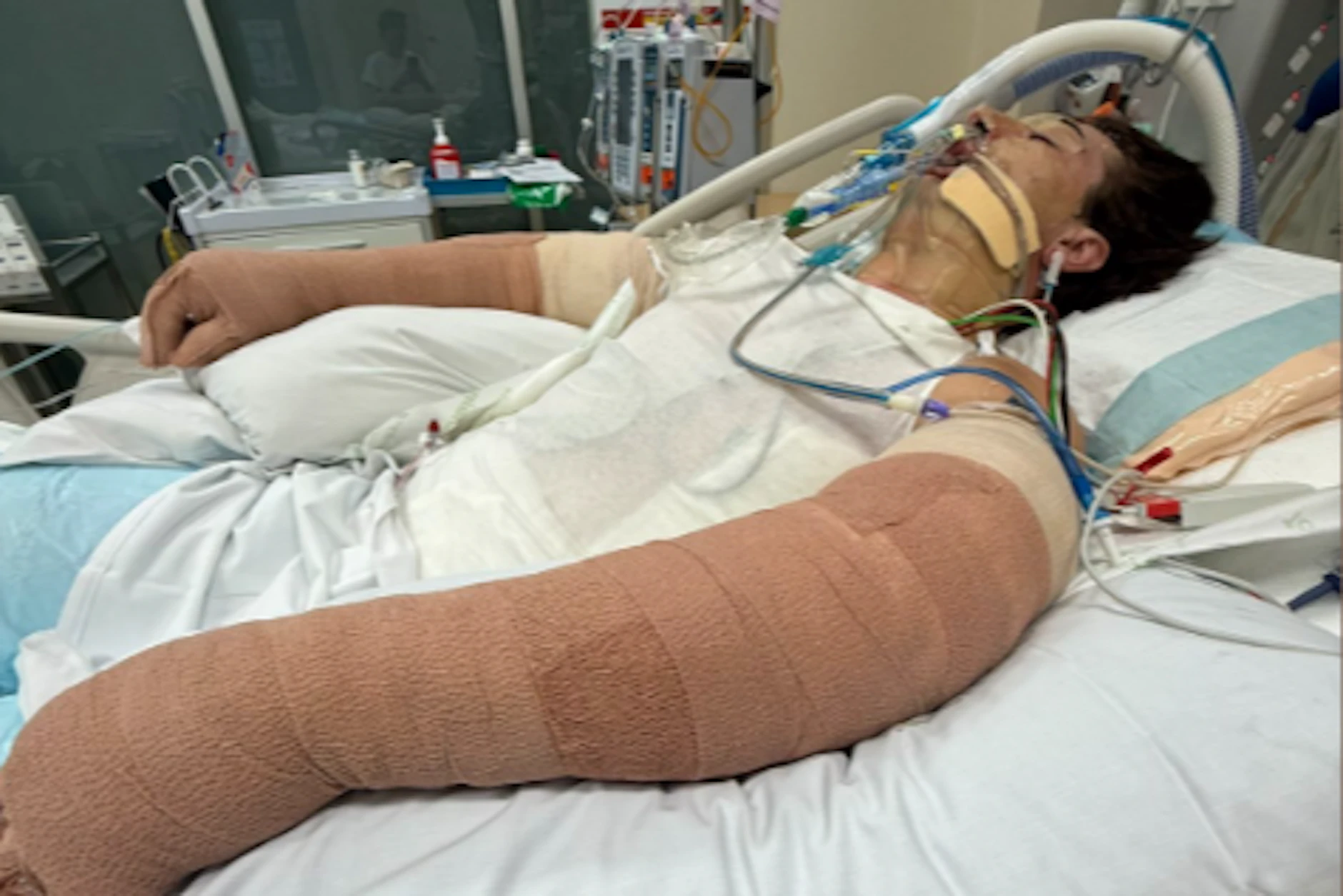 Lachie Perrem&nbsp; kurz nach dem Unglück in einer Klinik. Eine Woche lag er im künstlichen Koma.
