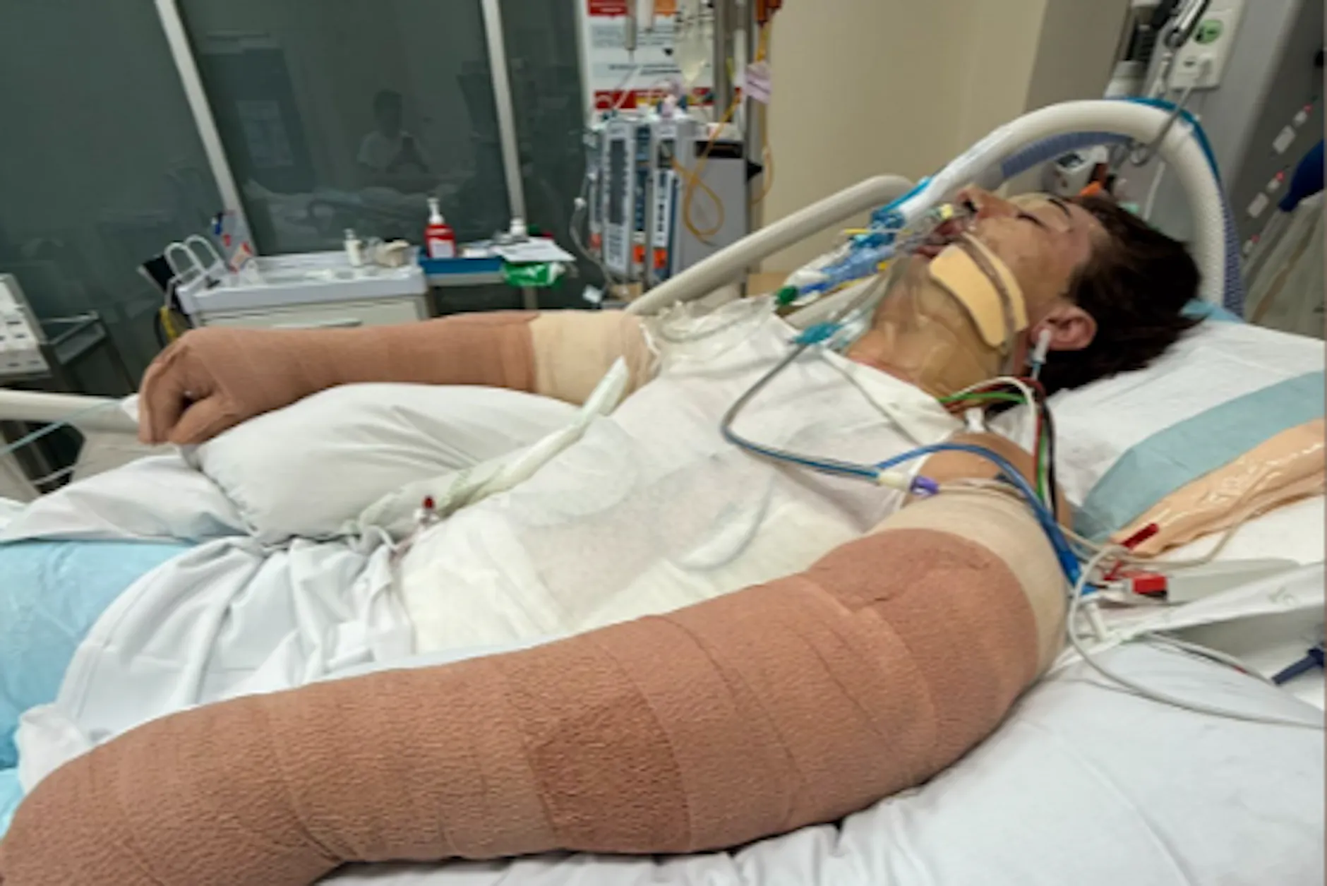 Saugroboter explodiert! 25-Jähriger kämpft um sein Leben
