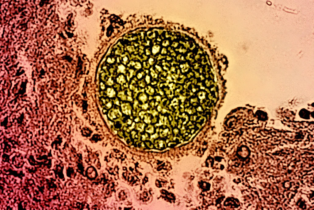 Mikroskopaufnahme einer Coccidioides-Sphärule: In dieser Form vermehrt sich der Pilz im Körper und kann Valley Fever auslösen.