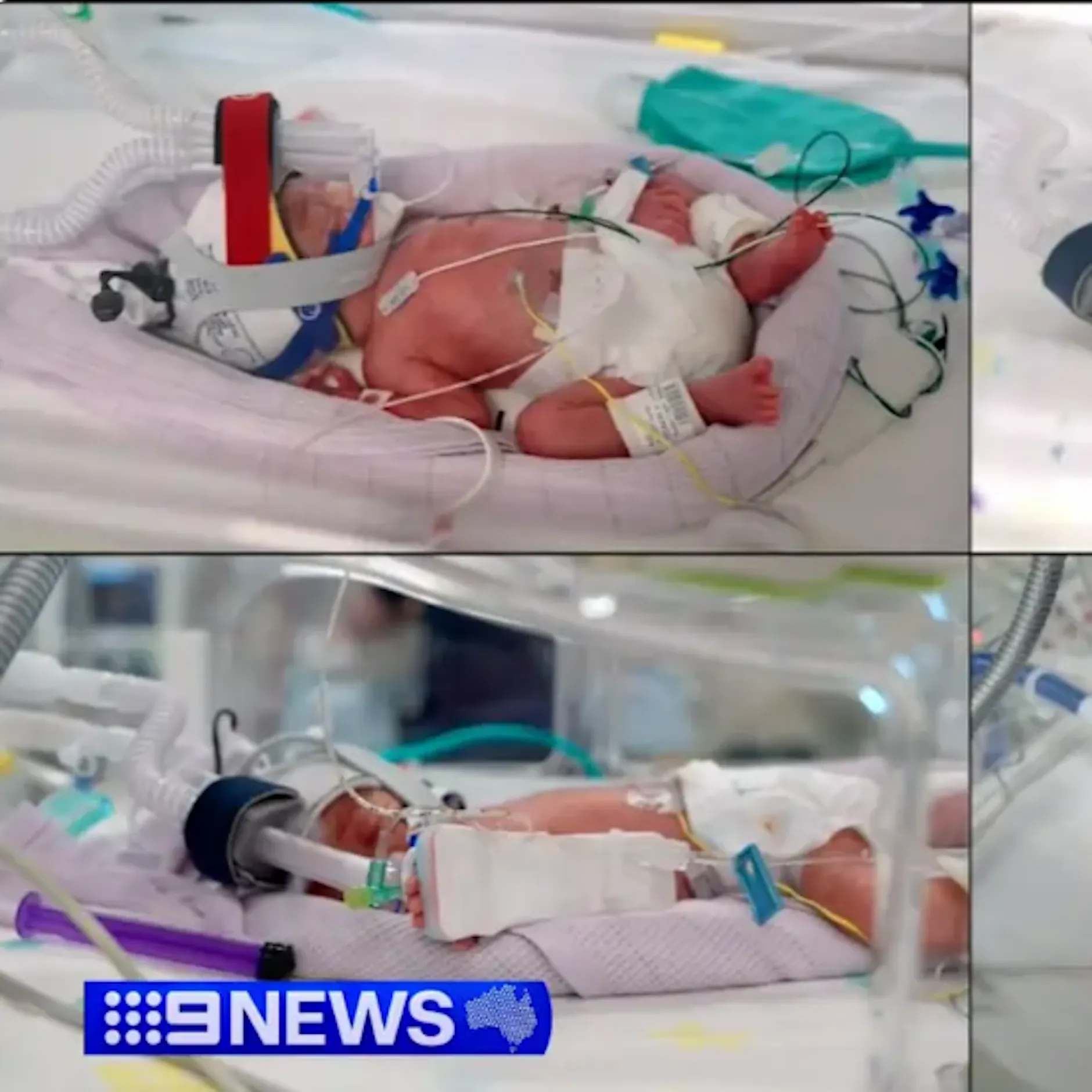 Babywunder! Frau in Australien bringt eineiige Vierlinge zur Welt